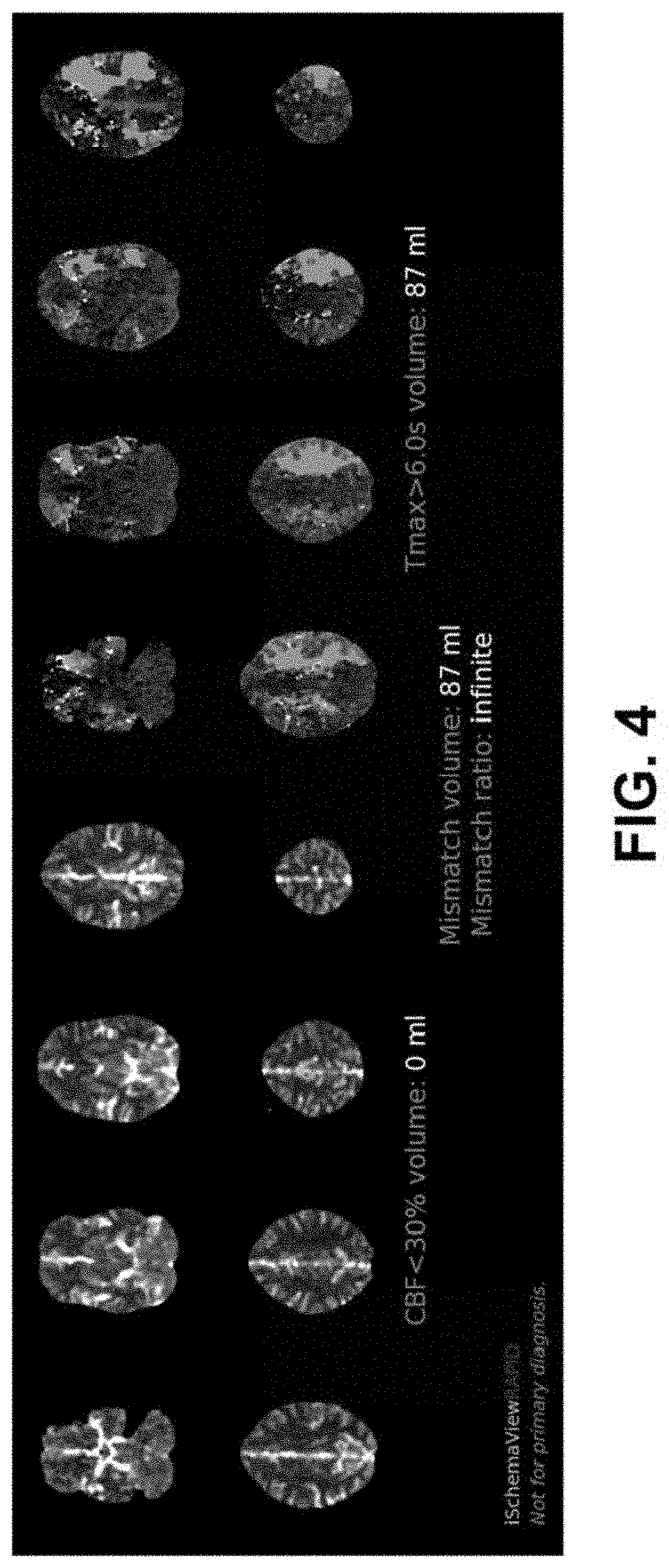 Patent US11776126 Figure 3 – Systems and methods for evaluating the brain after onset of a stroke using computed tomography angiography