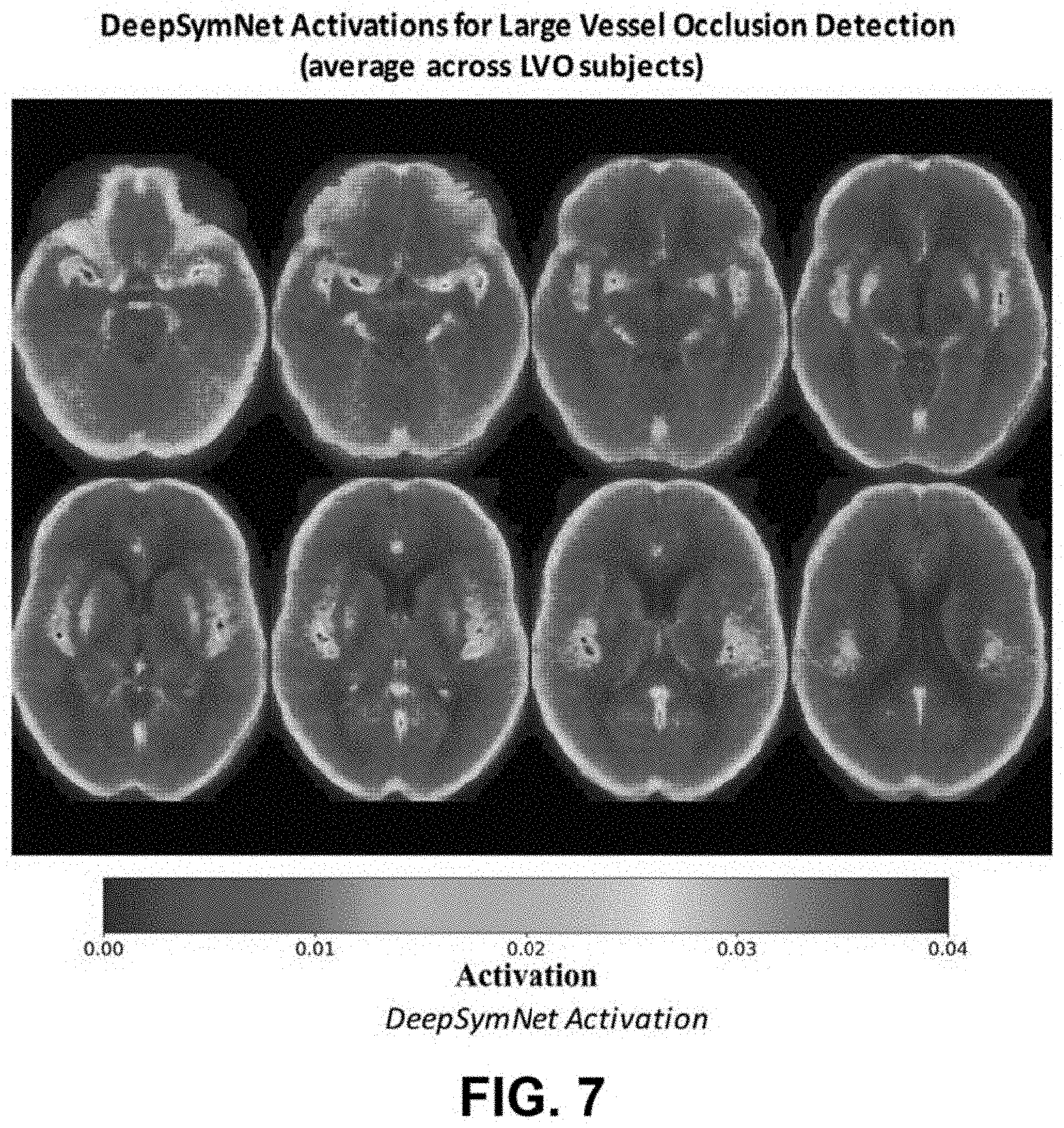 Patent US11776126 Figure 6 – Systems and methods for evaluating the brain after onset of a stroke using computed tomography angiography