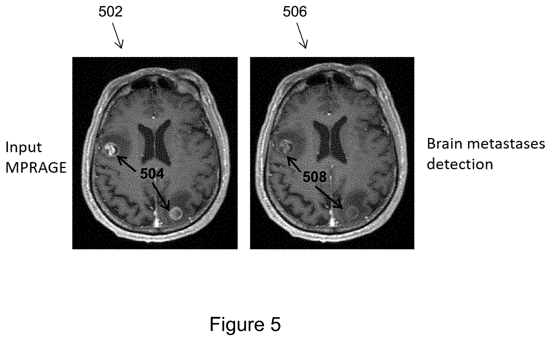 Patent US11776128 Figure 5 – Automatic detection of lesions in medical images using 2D and 3D deep learning networks