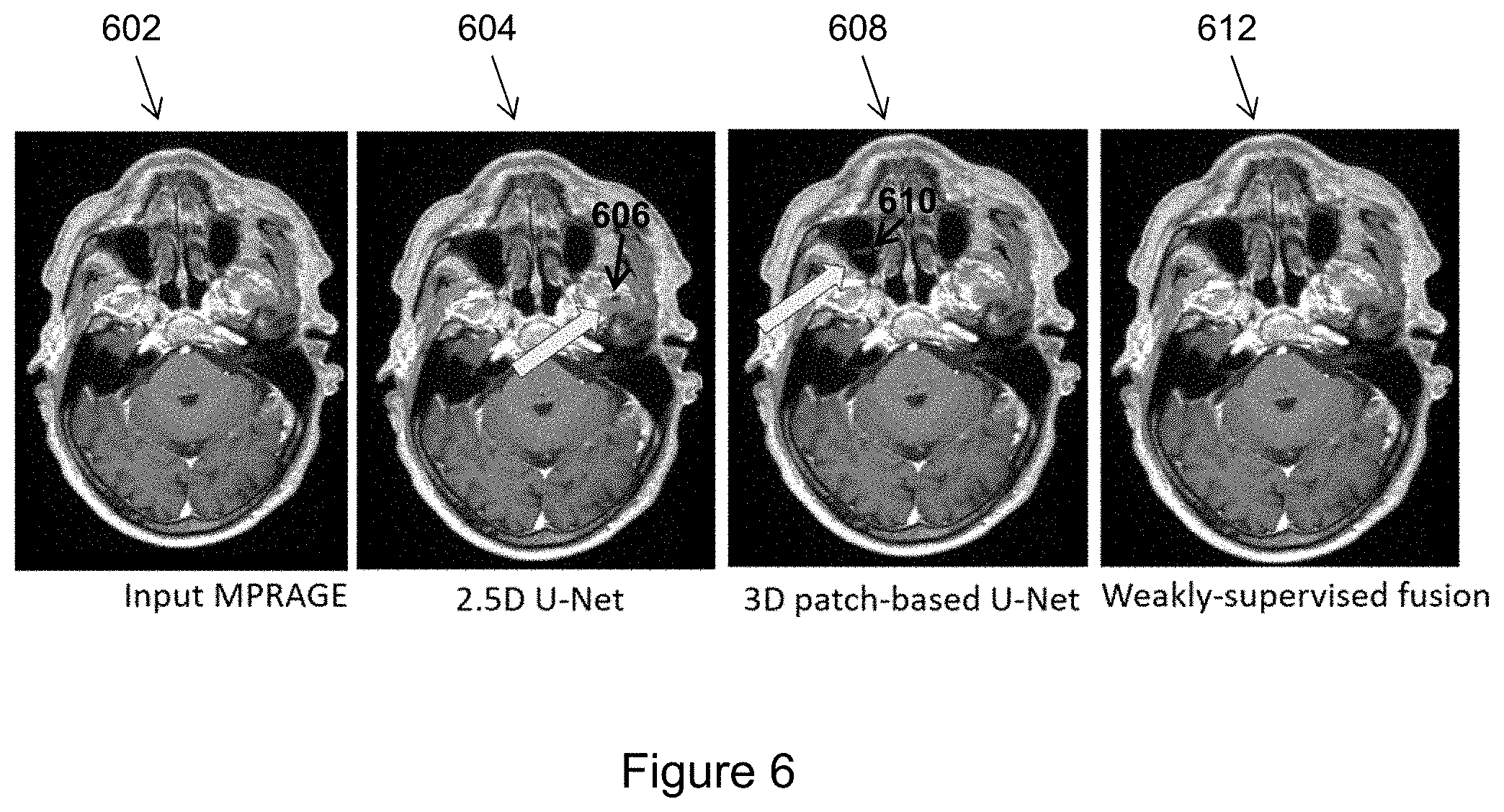 Patent US11776128 Figure 6 – Automatic detection of lesions in medical images using 2D and 3D deep learning networks