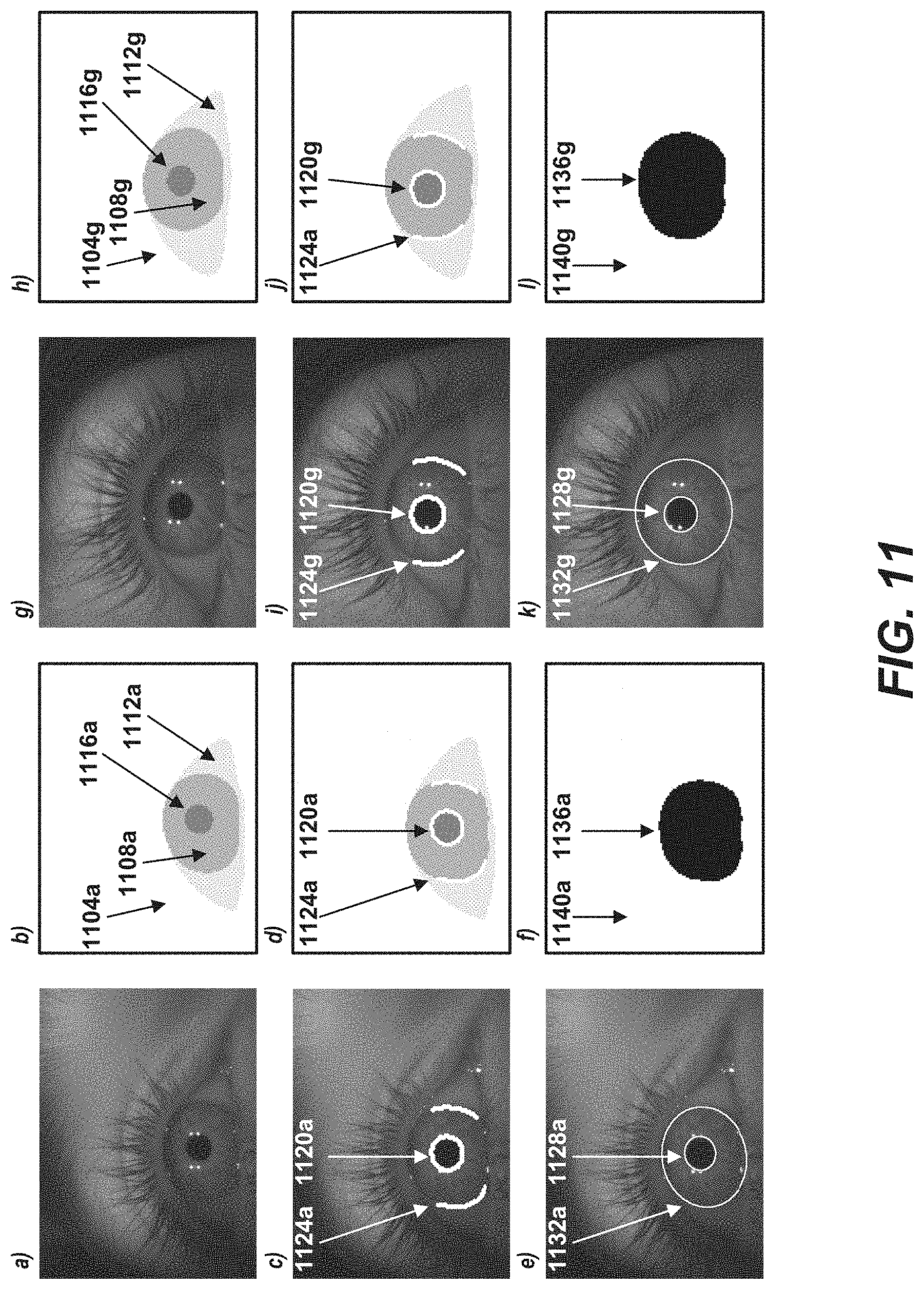 Patent US11776131 Figure 15 – Neural network for eye image segmentation and image quality estimation
