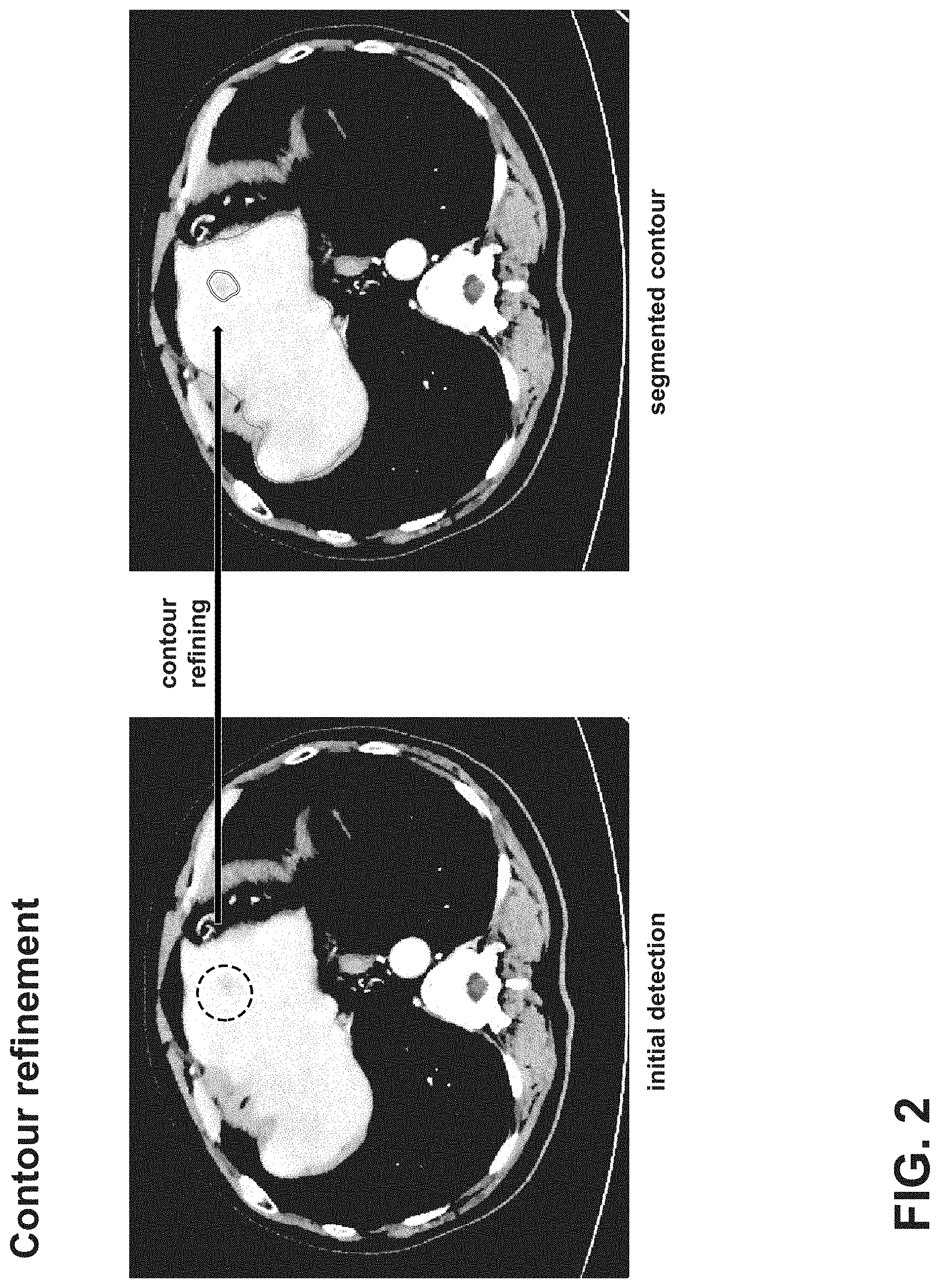 Patent US11776132 Figure 2 – Multi-phase object contour refinement
