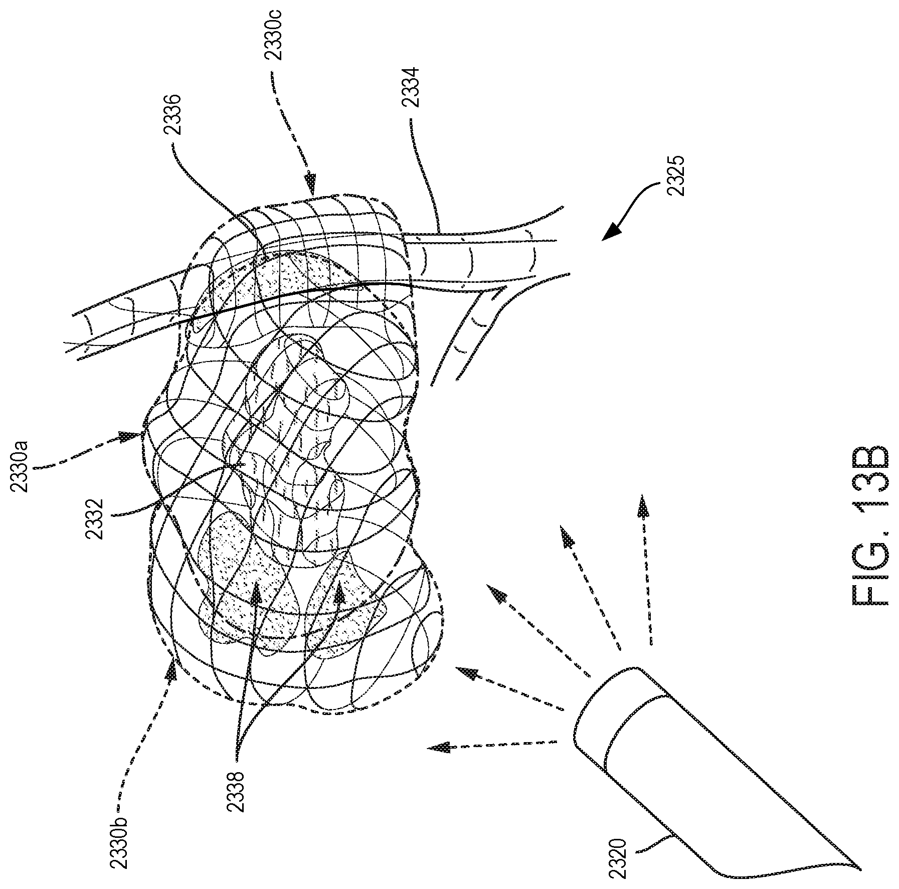 Patent US11776144 Figure 13 – System and method for determining, adjusting, and managing resection margin about a subject tissue