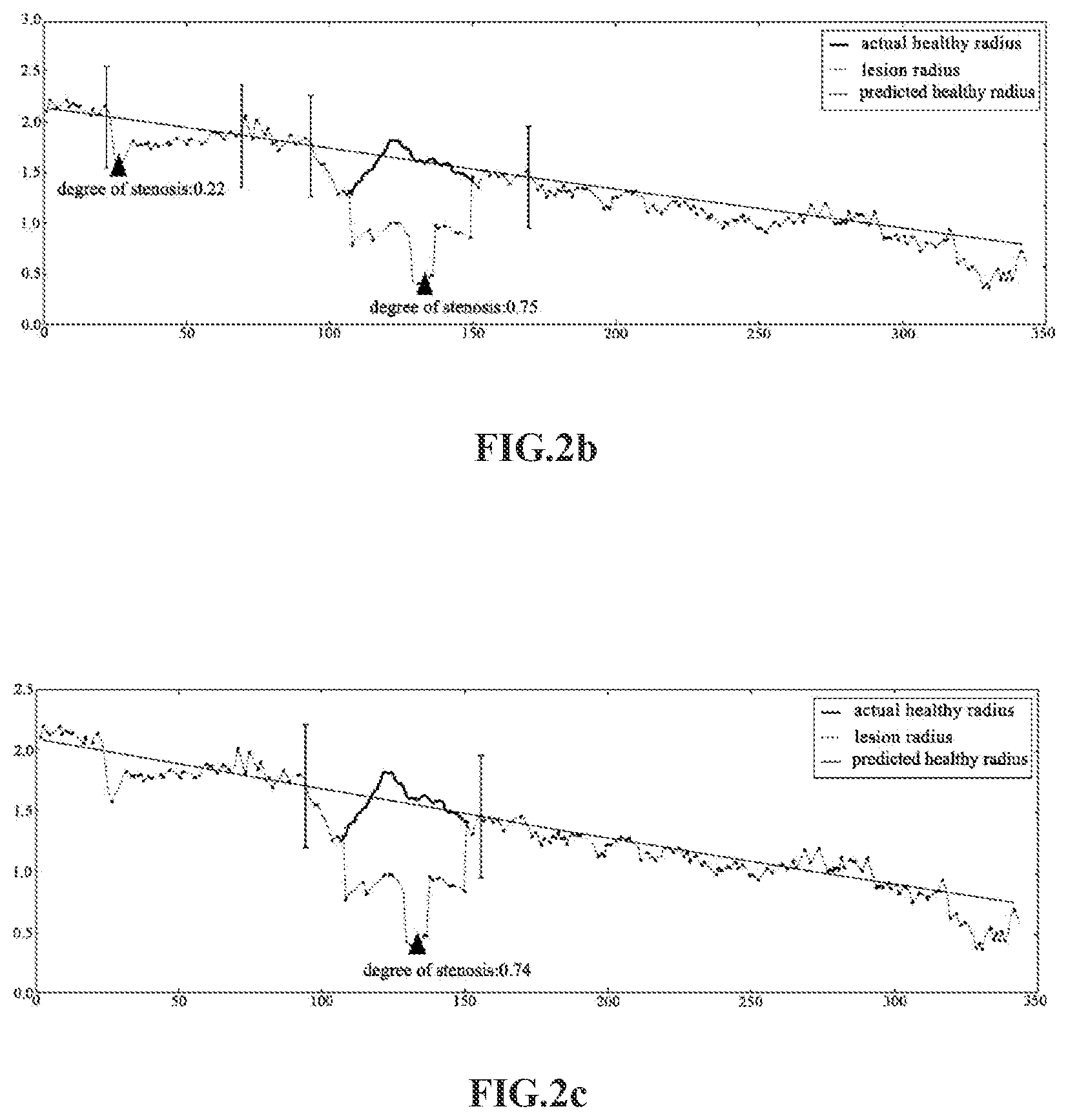 Patent US11776149 Figure 2 – Prediction method for healthy radius of blood vessel path, prediction method for candidate stenosis of blood vessel path, and blood vessel stenosis degree prediction device