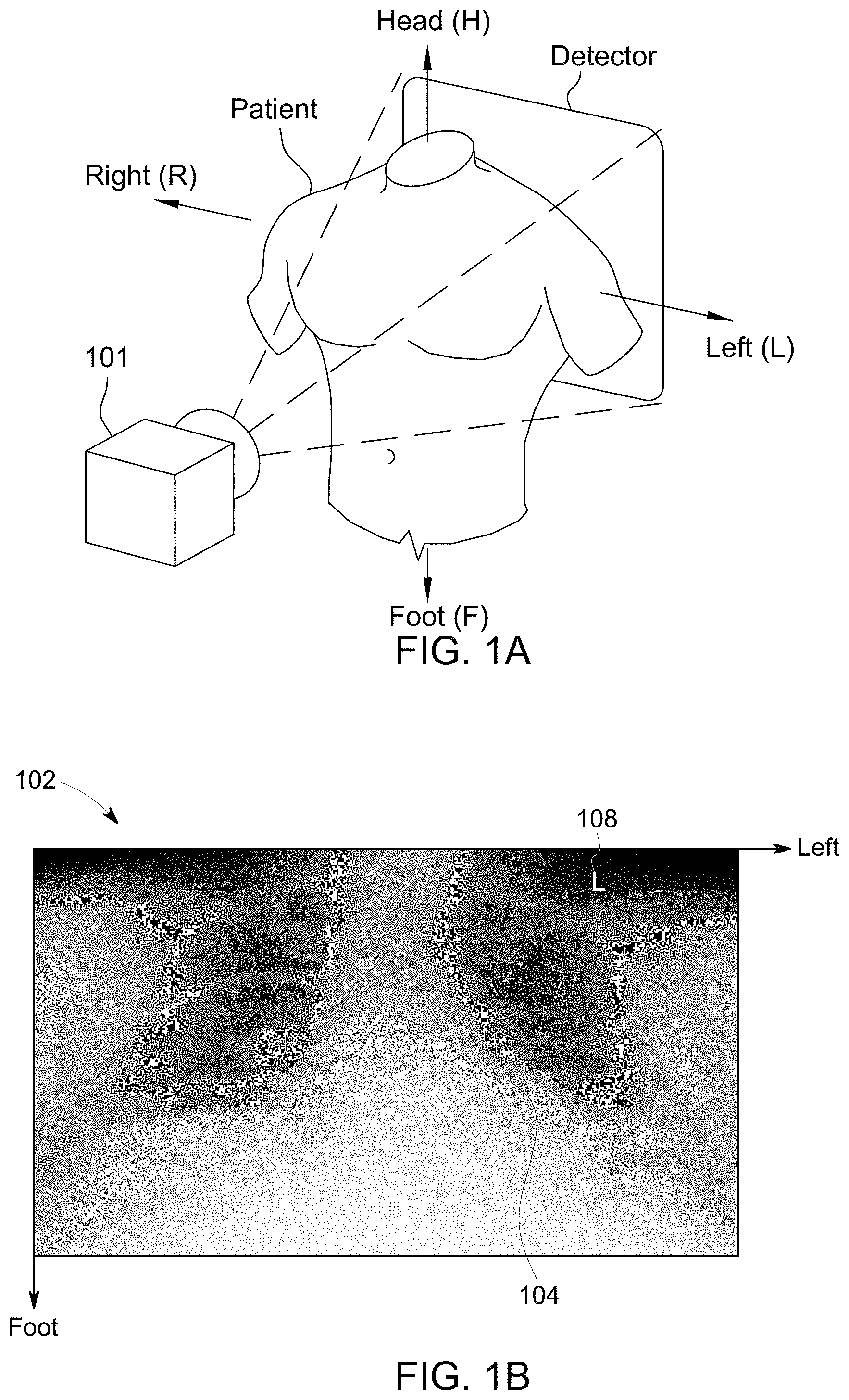 Patent US11776150 Figure 1 – Systems and methods for detecting laterality of a medical image
