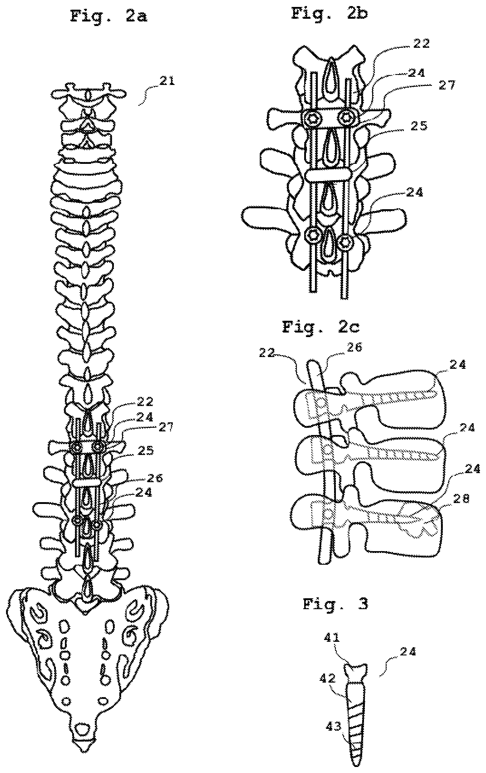 Patent US11776154 Figure 2 – Method and device for medical imaging for representing a 3D volume containing at least one introduced foreign object