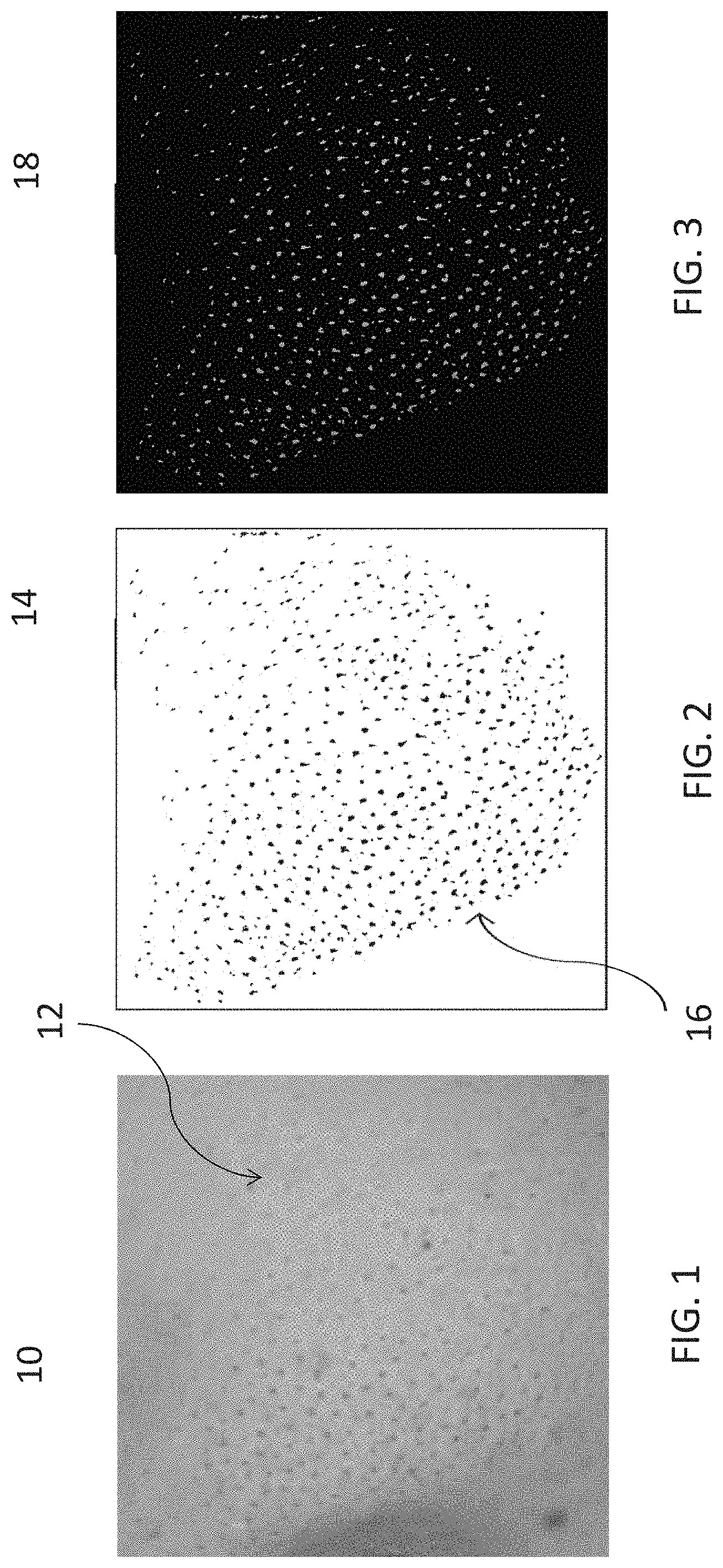 Patent US11776161 Figure 1 – Methods for identifying pore color