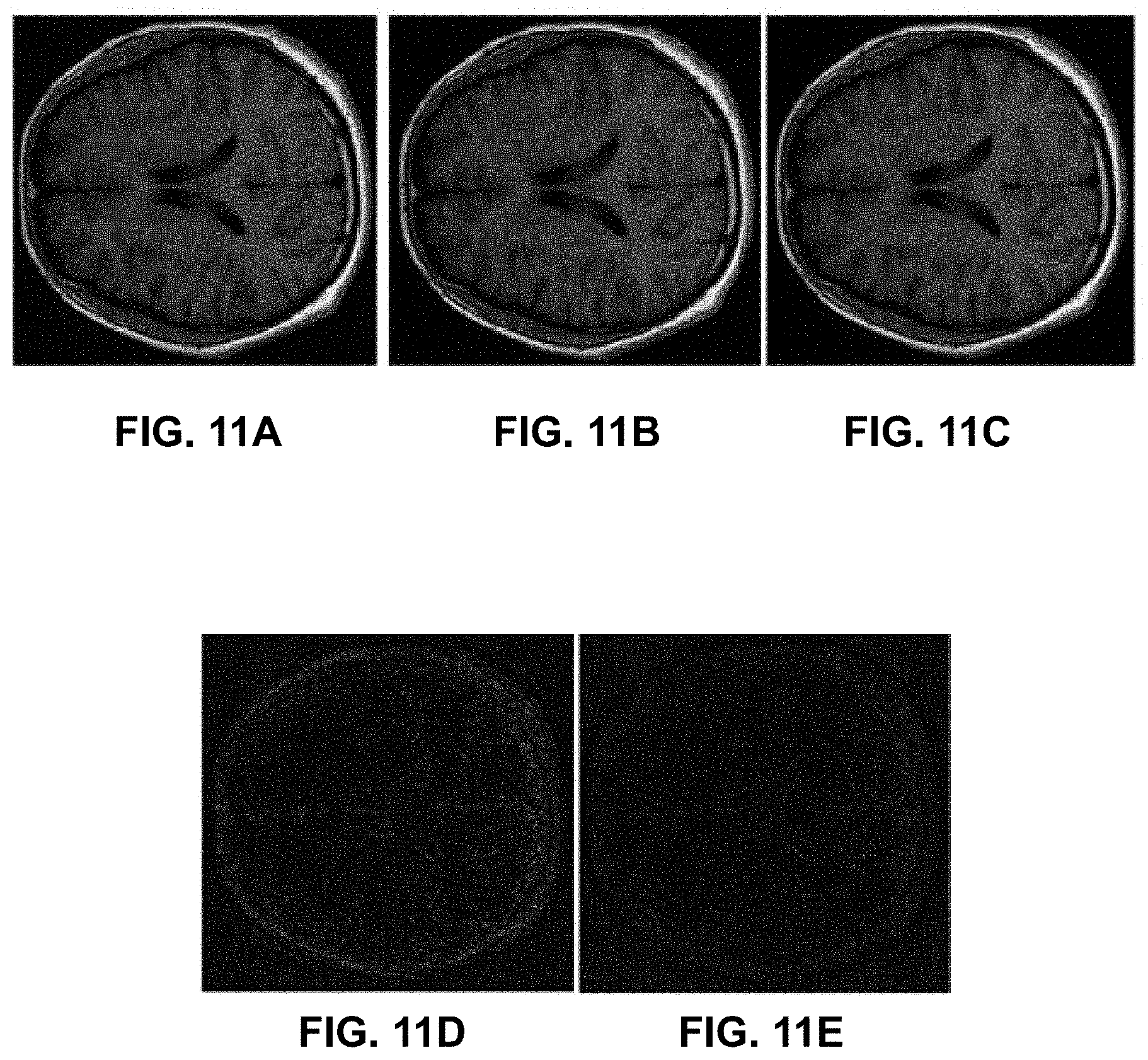 Patent US11776171 Figure 11 – Systems and methods for magnetic resonance image reconstruction