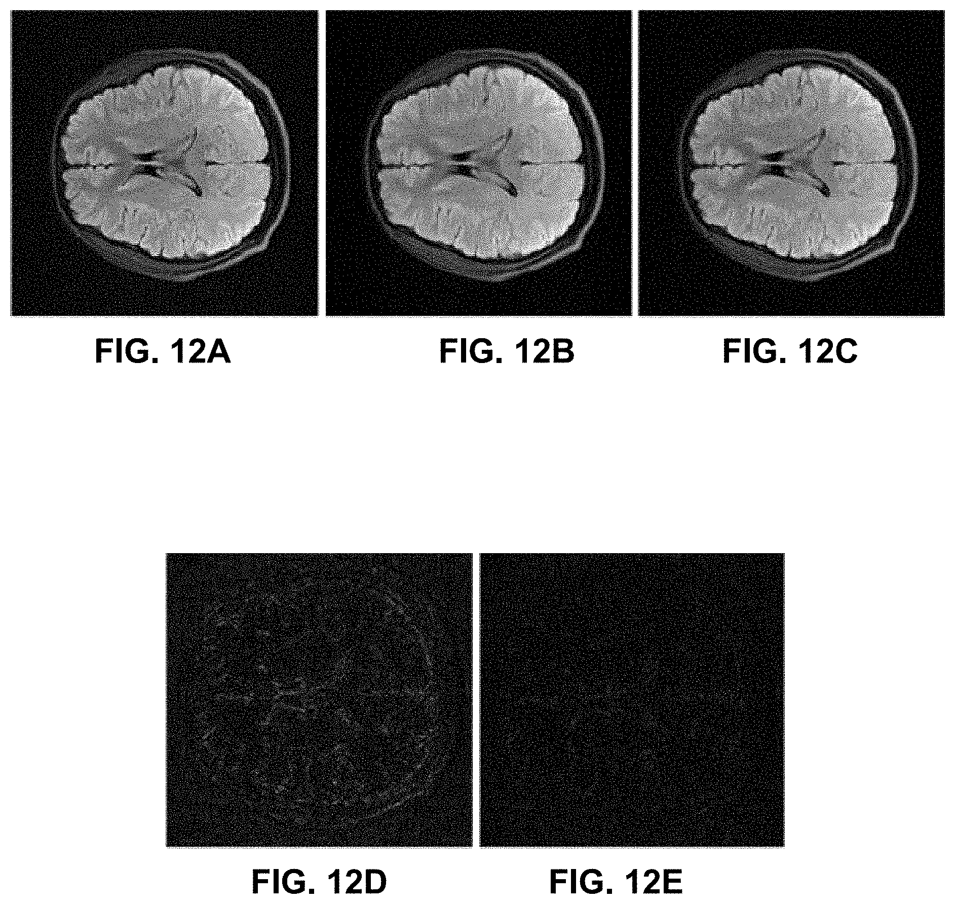 Patent US11776171 Figure 12 – Systems and methods for magnetic resonance image reconstruction