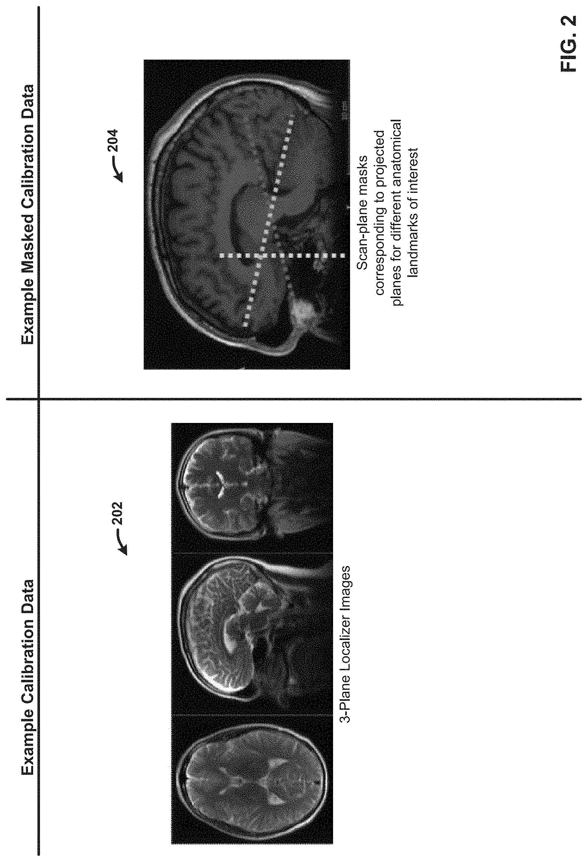 Patent US11776173 Figure 2 – Generating reformatted views of a three-dimensional anatomy scan using deep-learning estimated scan prescription masks