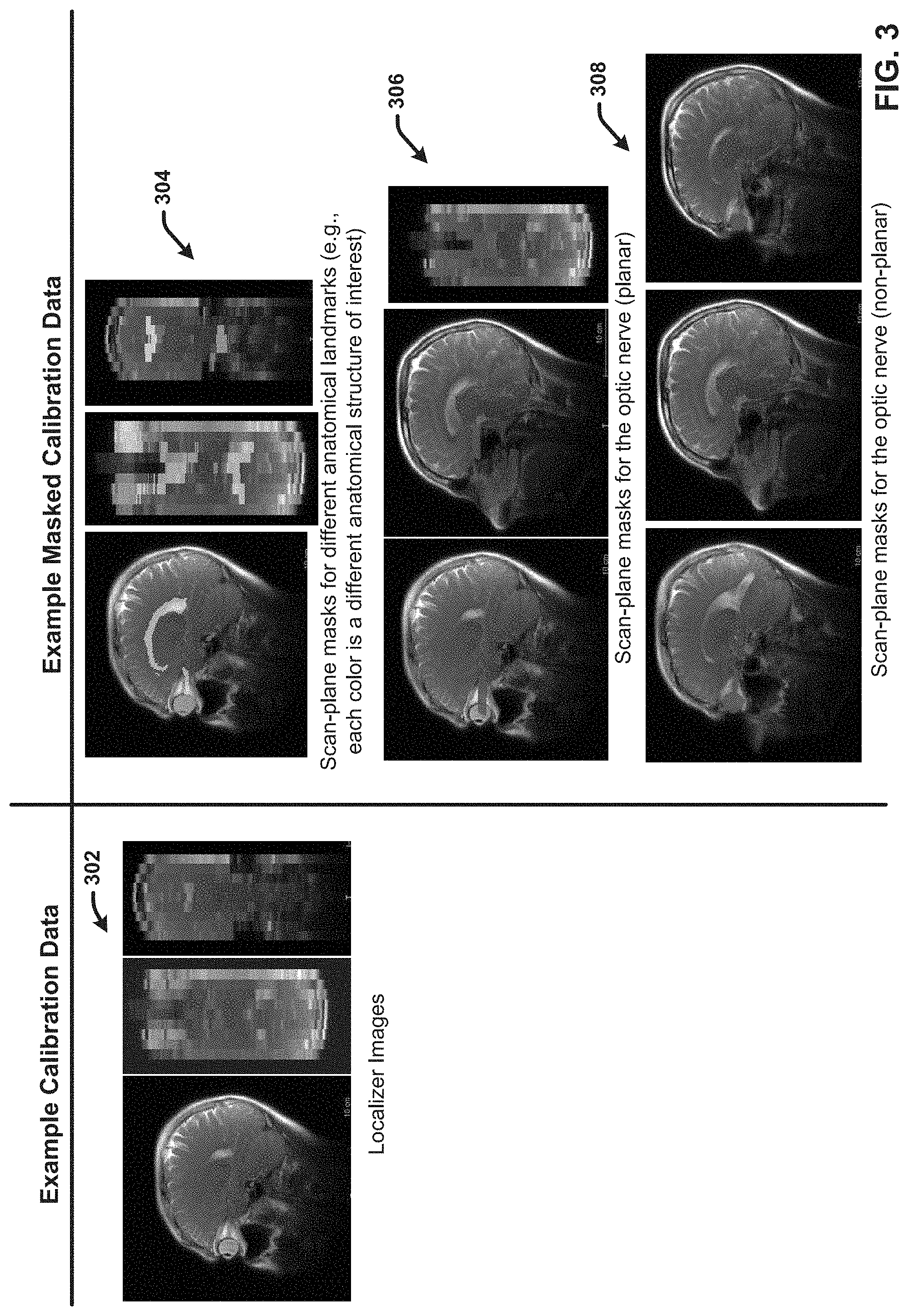 Patent US11776173 Figure 3 – Generating reformatted views of a three-dimensional anatomy scan using deep-learning estimated scan prescription masks