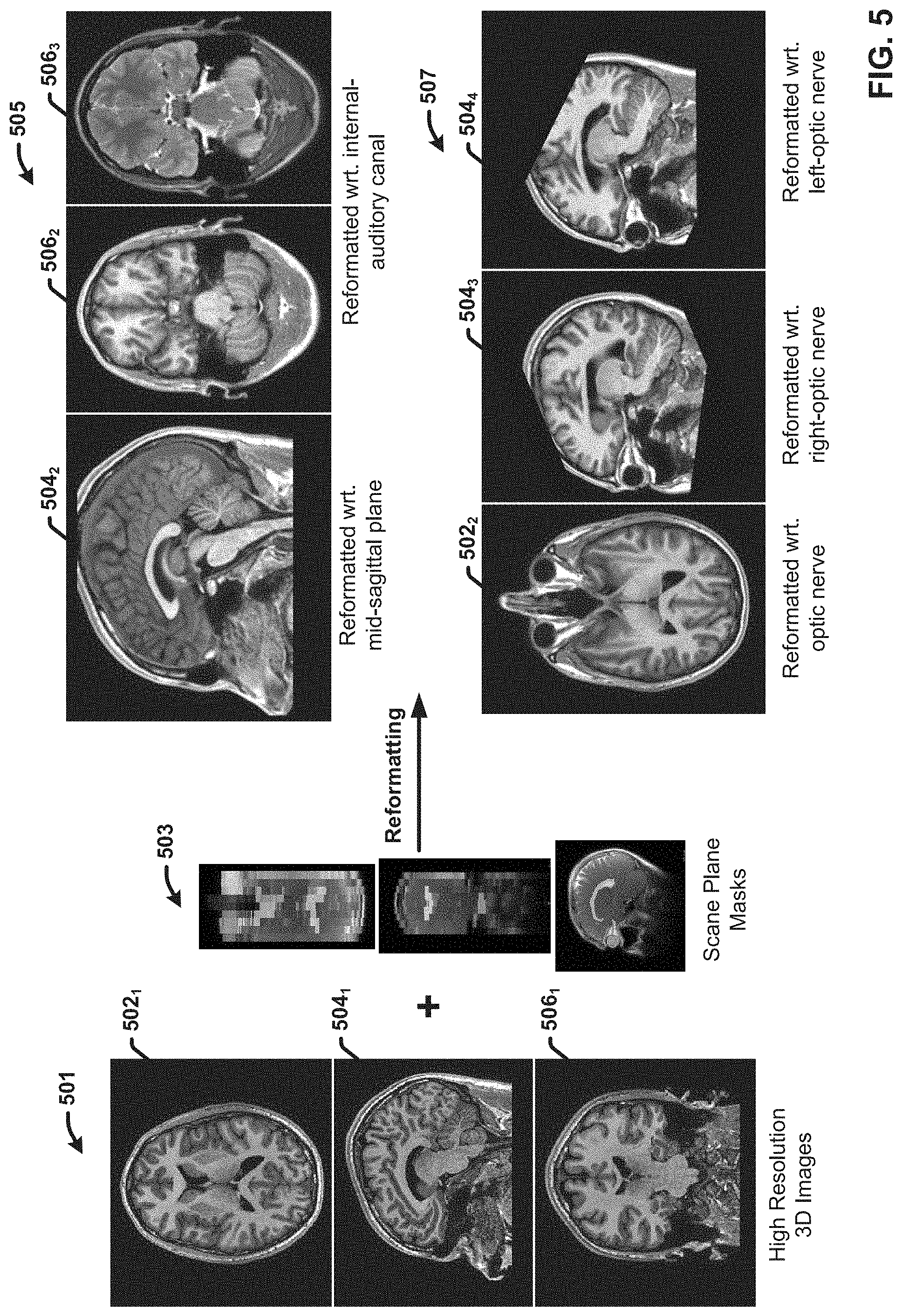 Patent US11776173 Figure 5 – Generating reformatted views of a three-dimensional anatomy scan using deep-learning estimated scan prescription masks