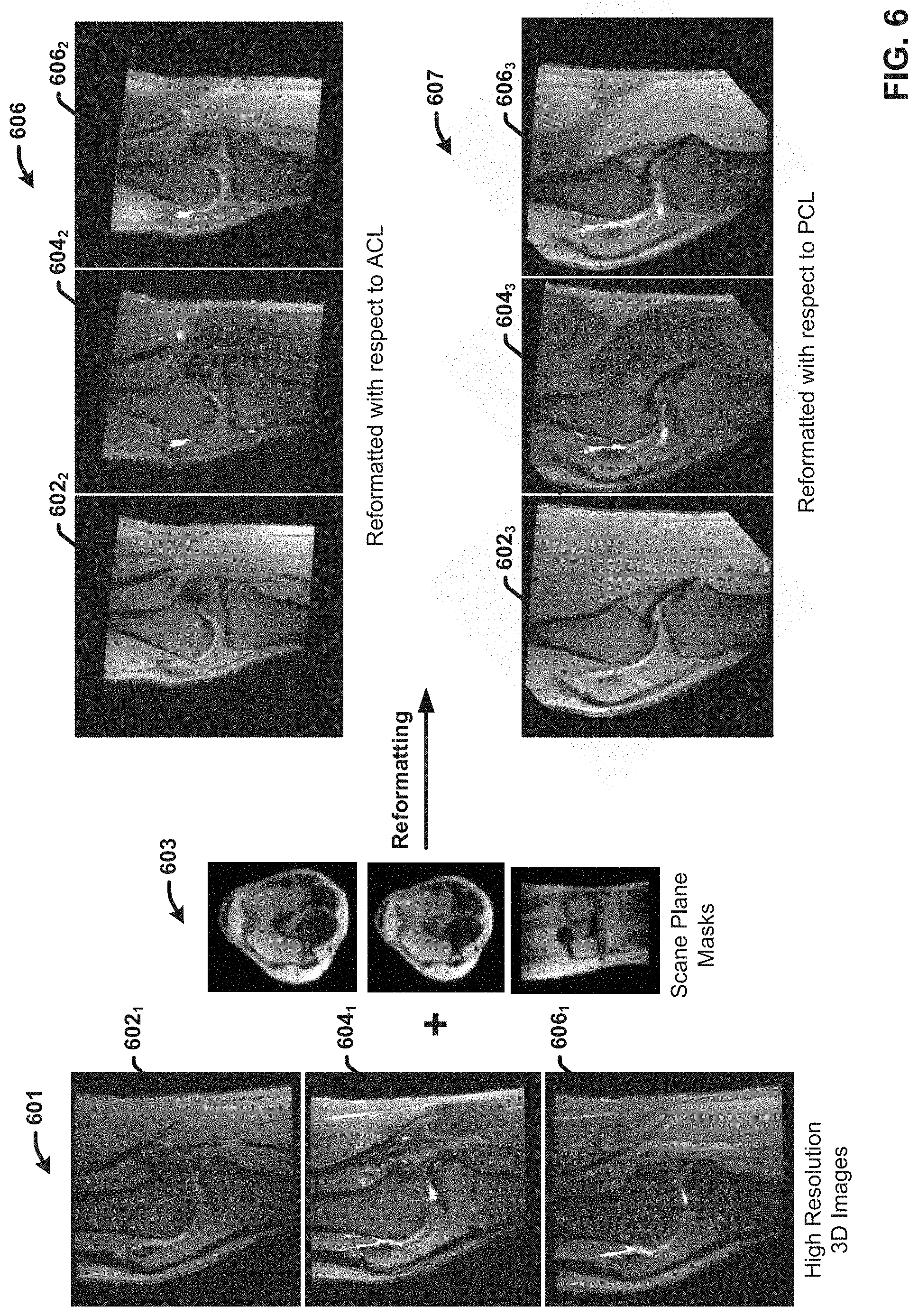 Patent US11776173 Figure 6 – Generating reformatted views of a three-dimensional anatomy scan using deep-learning estimated scan prescription masks