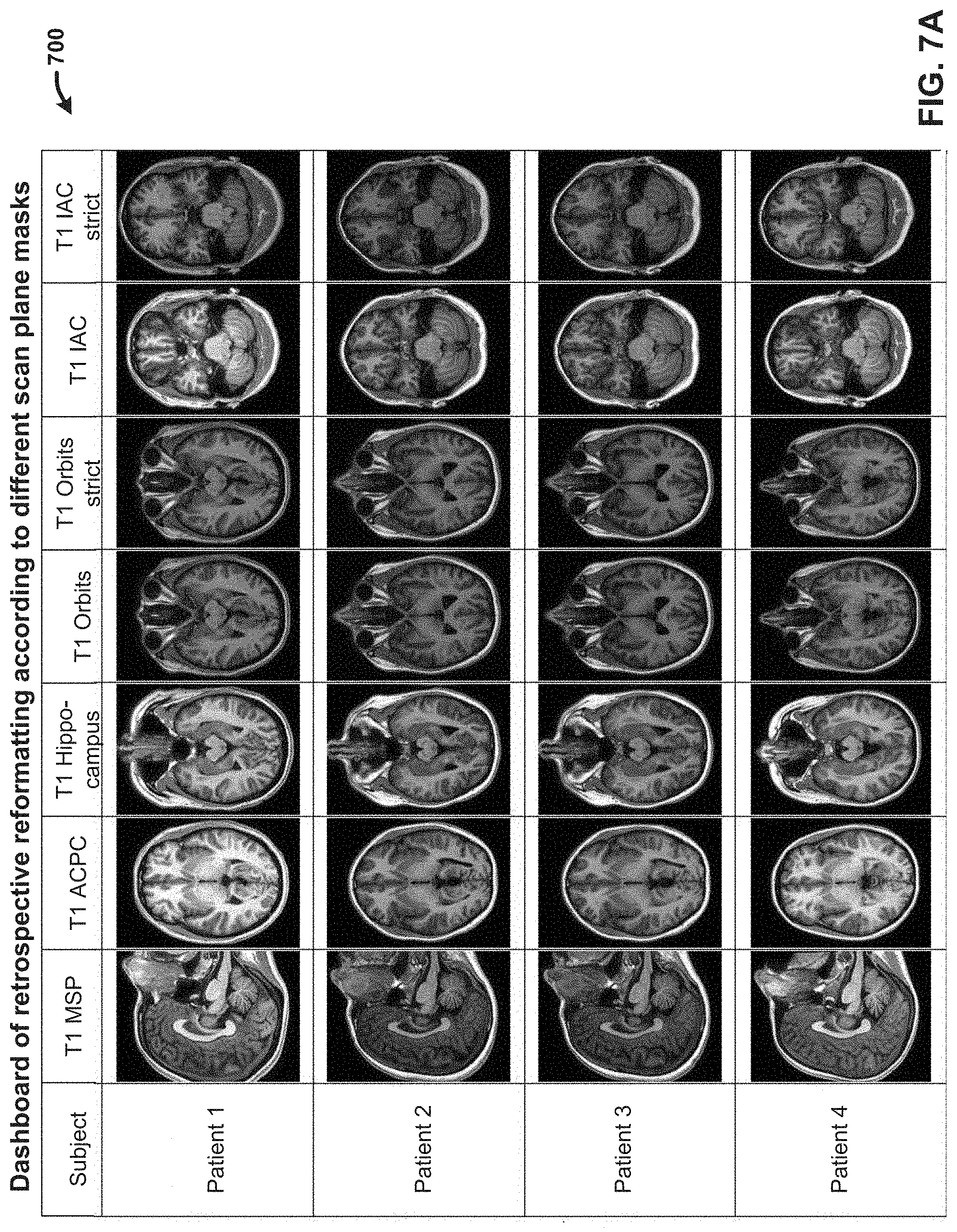 Patent US11776173 Figure 7 – Generating reformatted views of a three-dimensional anatomy scan using deep-learning estimated scan prescription masks