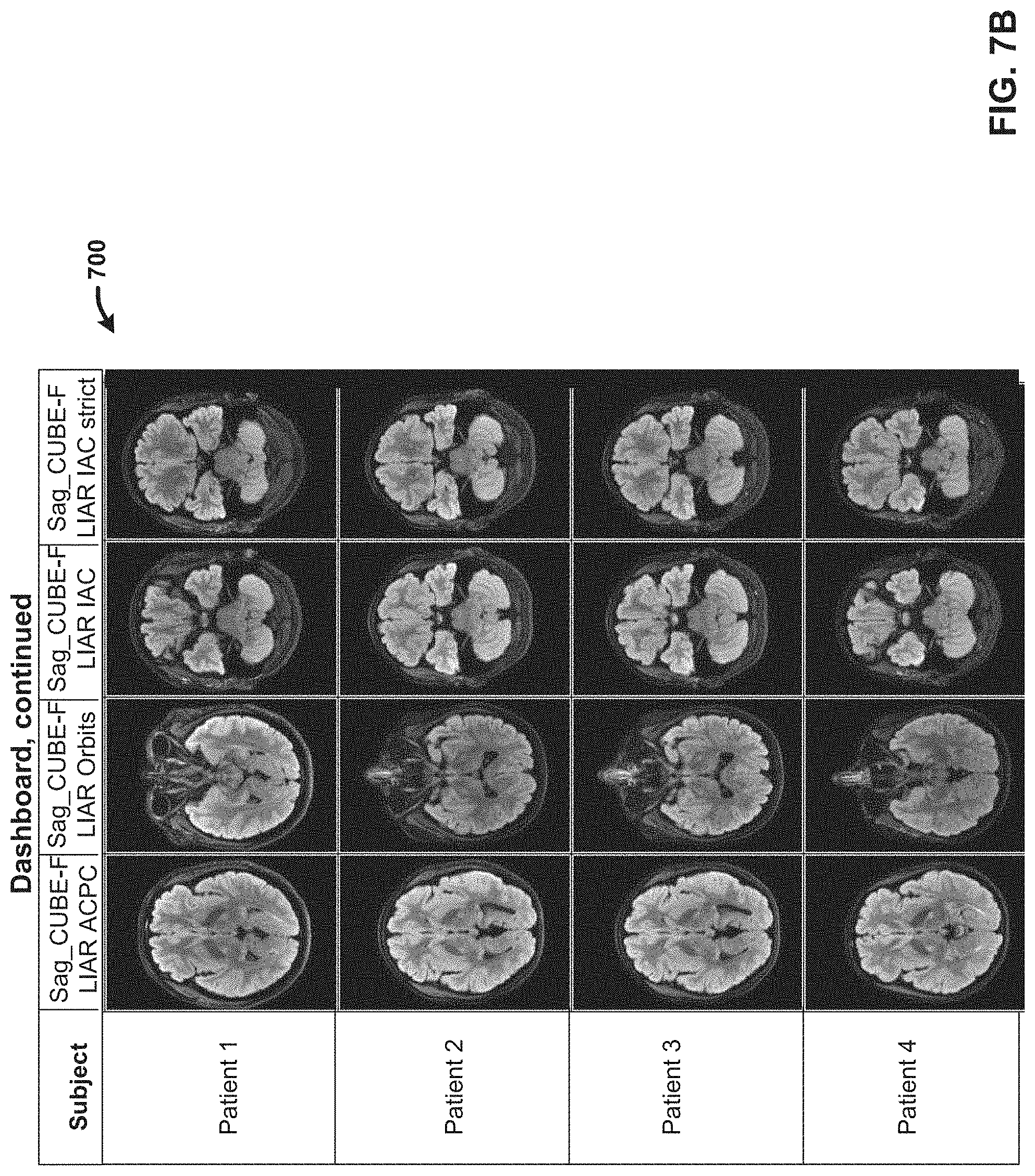 Patent US11776173 Figure 8 – Generating reformatted views of a three-dimensional anatomy scan using deep-learning estimated scan prescription masks