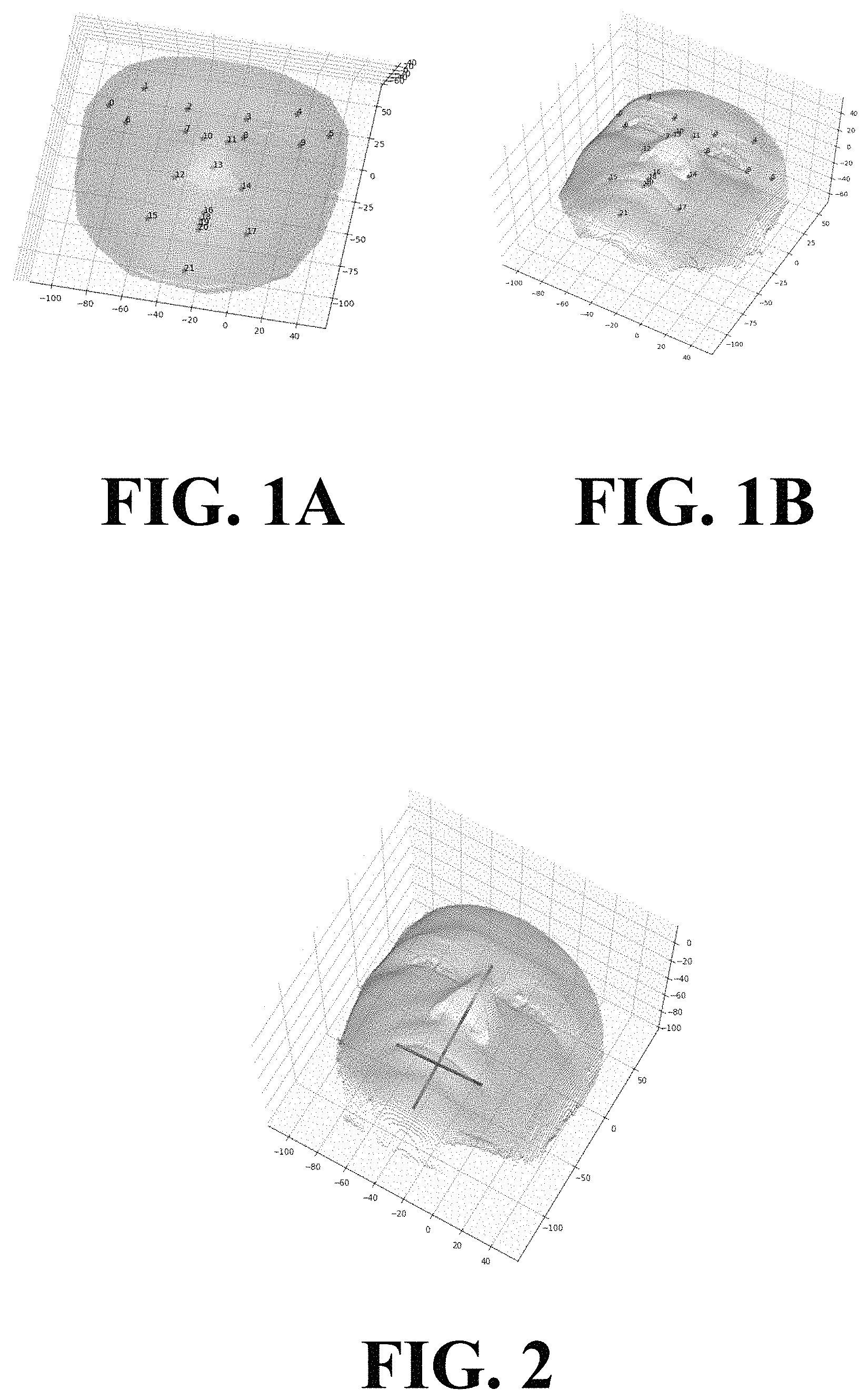 Patent US11776212 Figure 1 – Anatomically conforming apparatuses, systems, and methods, and applications thereof