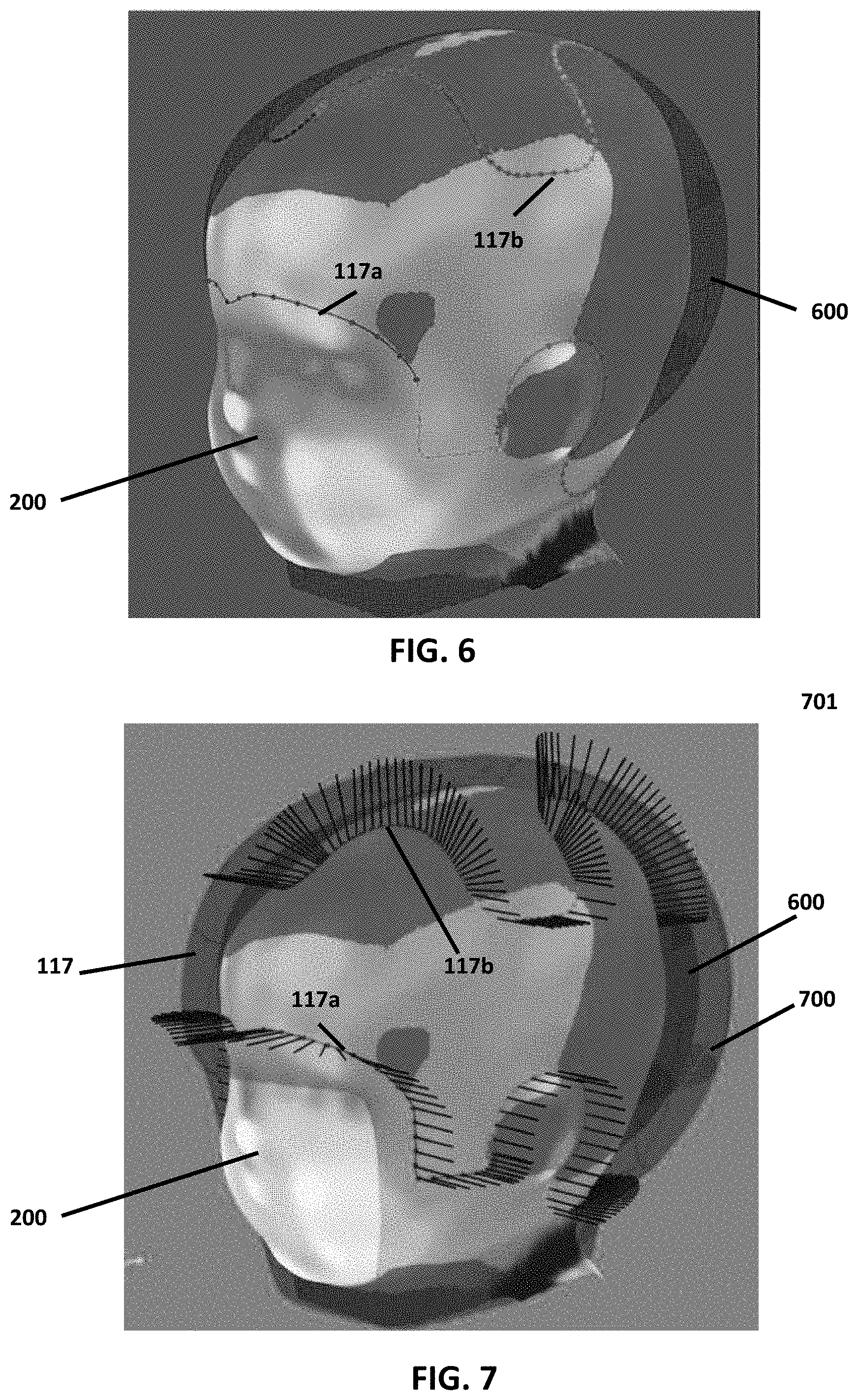 Patent US11776228 Figure 4 – Point of service manufacturing method for custom cranial remodeling device