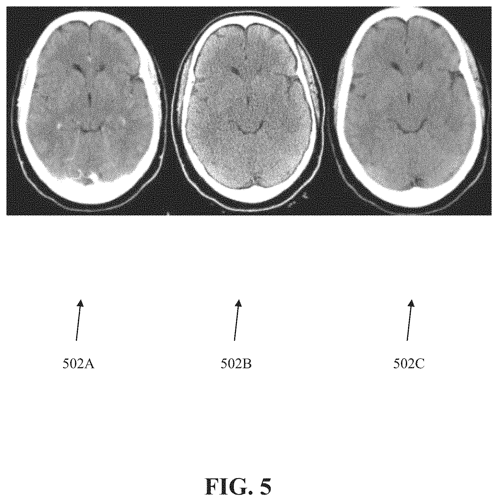 Patent US11776243 Figure 5 – Systems and methods for automated detection of visual objects in medical images