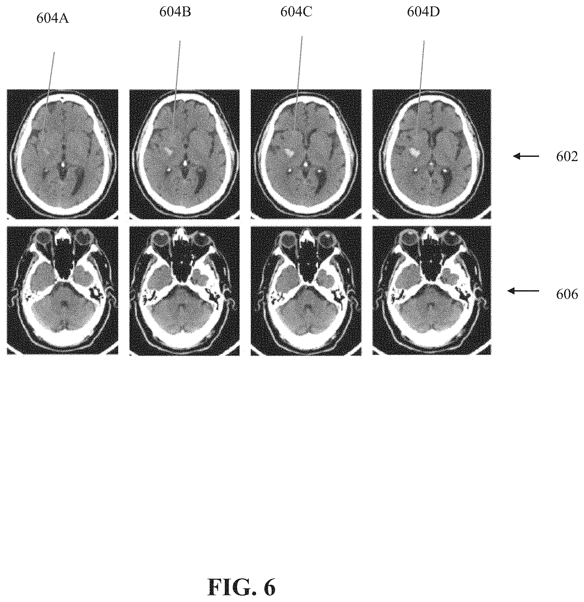 Patent US11776243 Figure 6 – Systems and methods for automated detection of visual objects in medical images