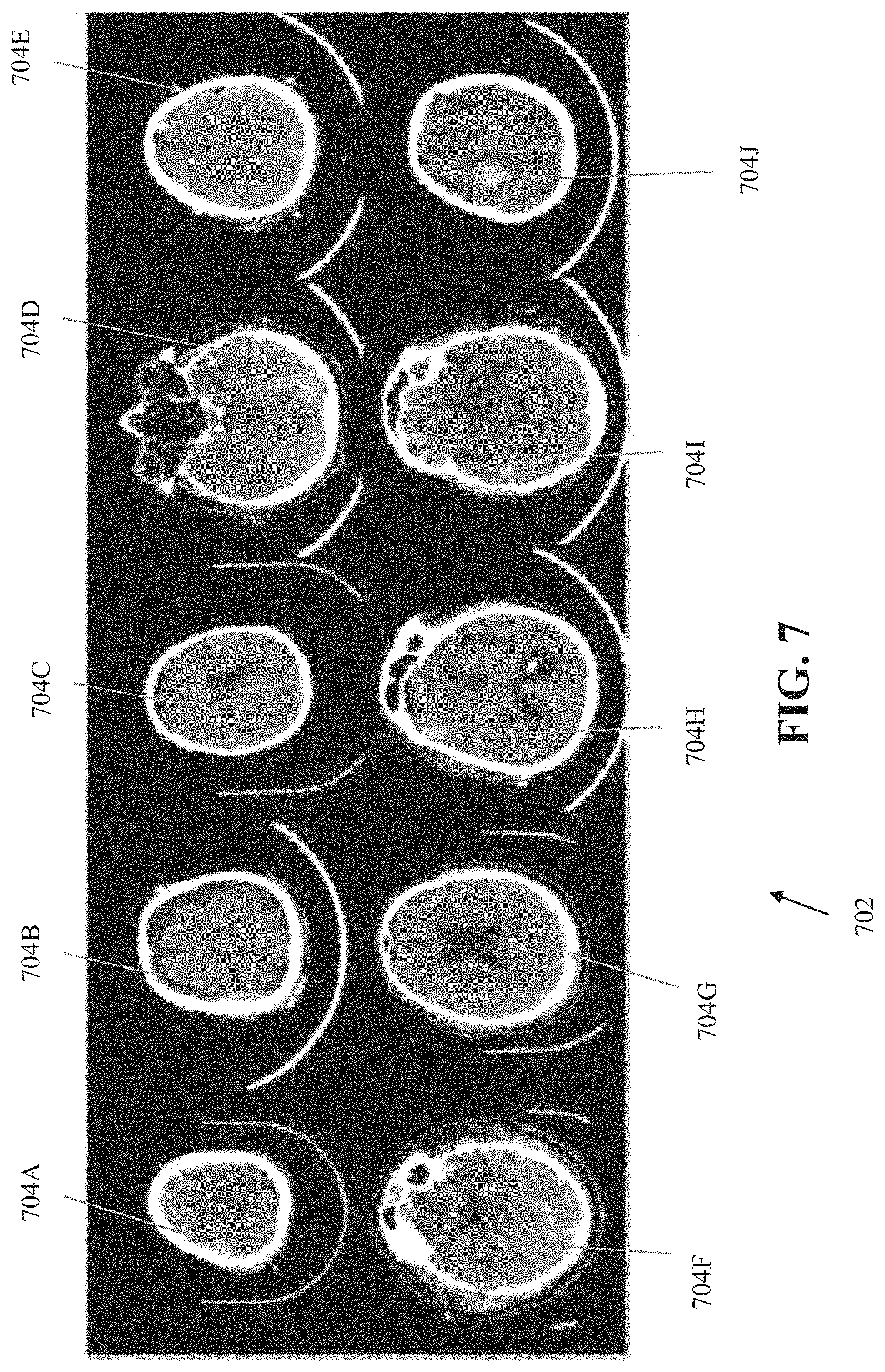 Patent US11776243 Figure 7 – Systems and methods for automated detection of visual objects in medical images
