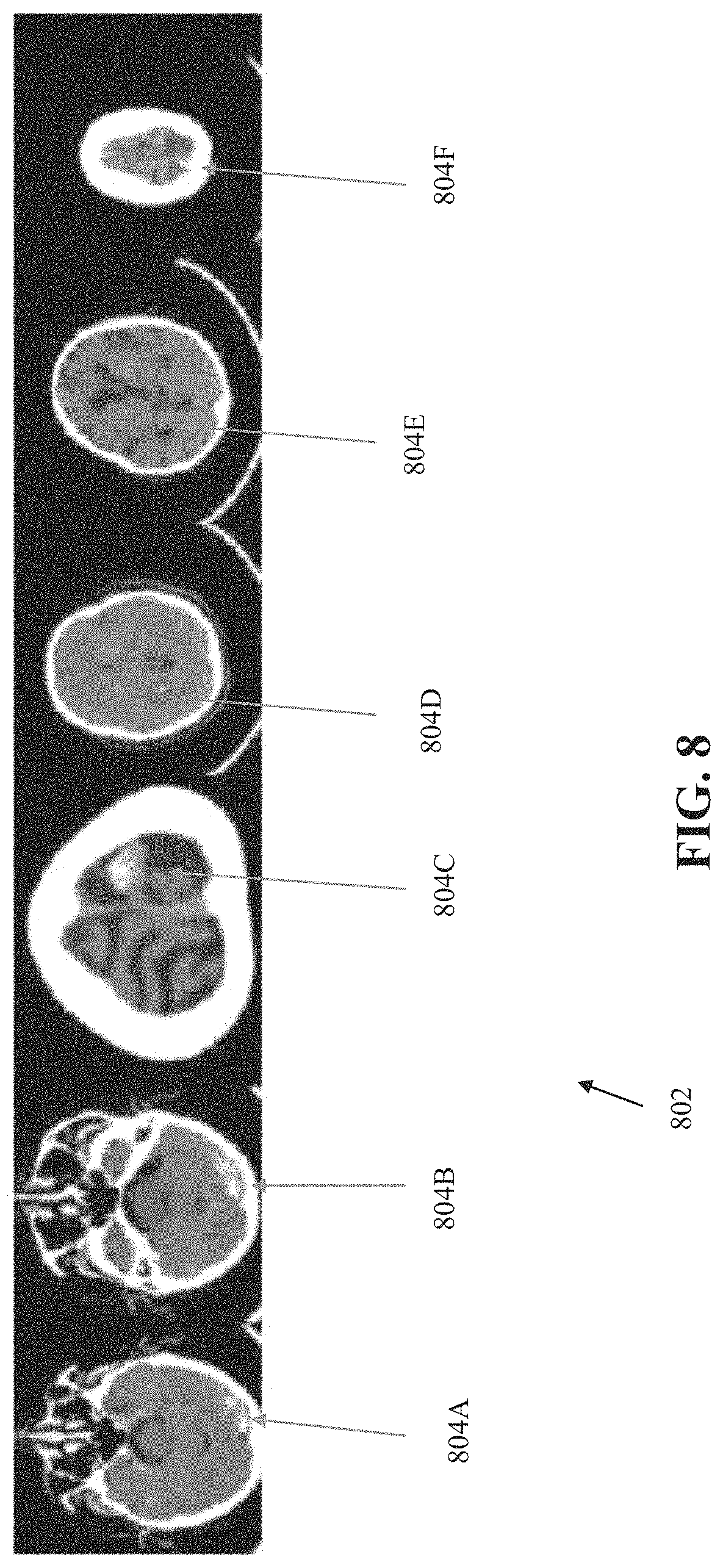 Patent US11776243 Figure 8 – Systems and methods for automated detection of visual objects in medical images