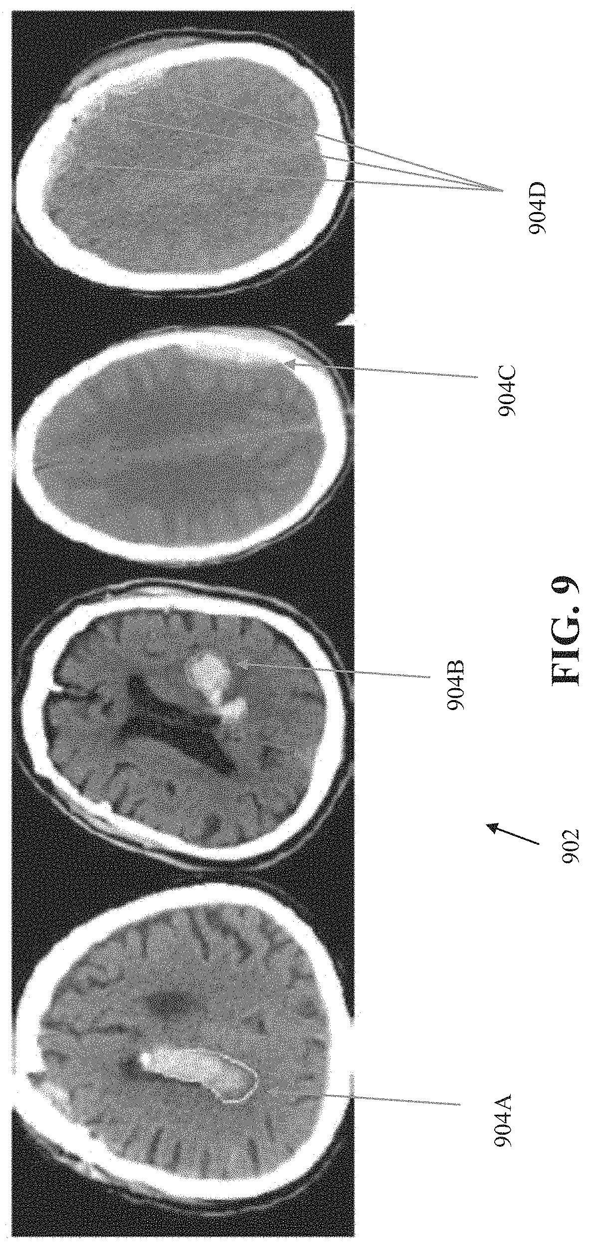 Patent US11776243 Figure 9 – Systems and methods for automated detection of visual objects in medical images