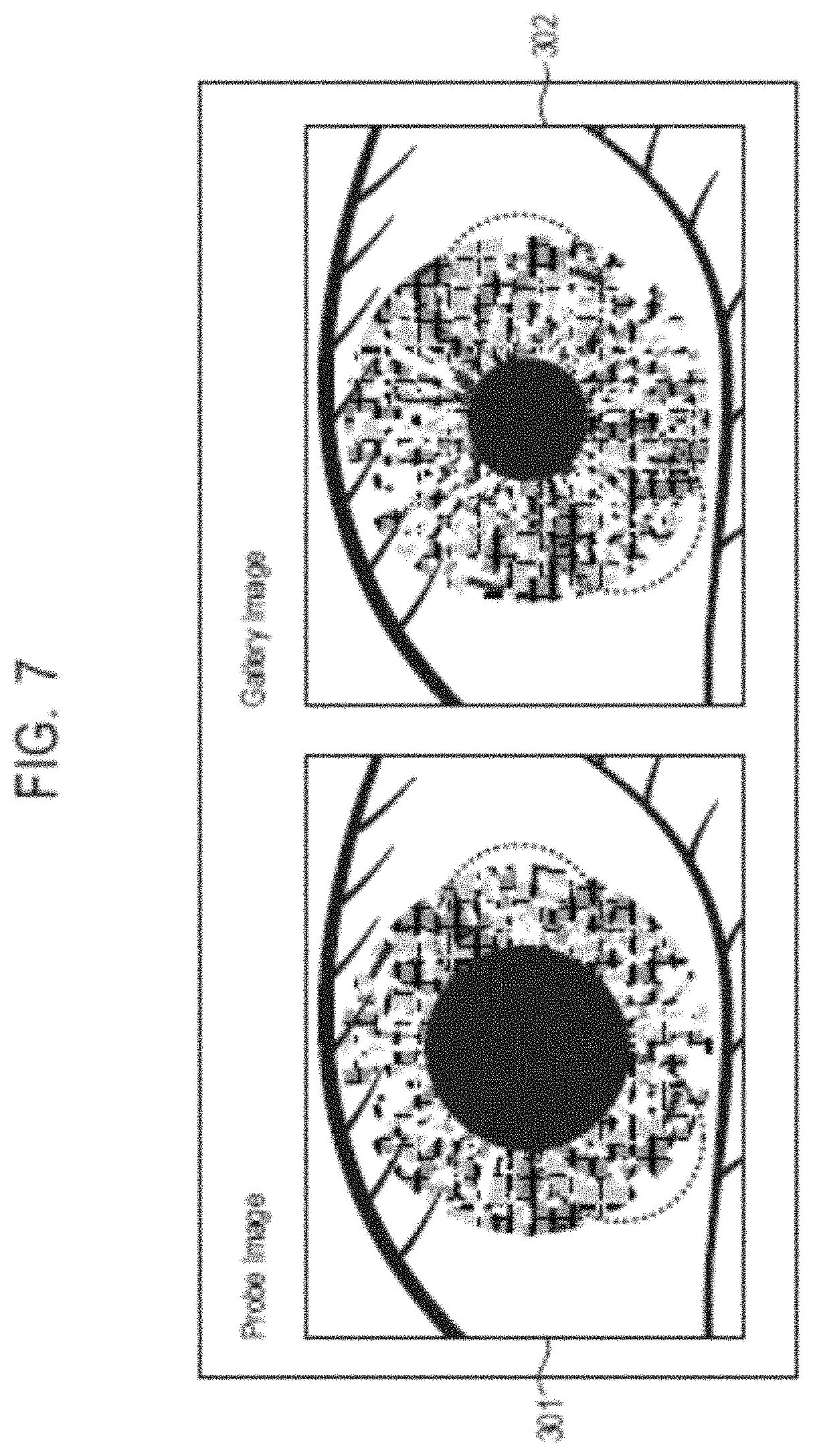 Patent US11776316 Figure 7 – Information processing system, information processing method, and storage medium