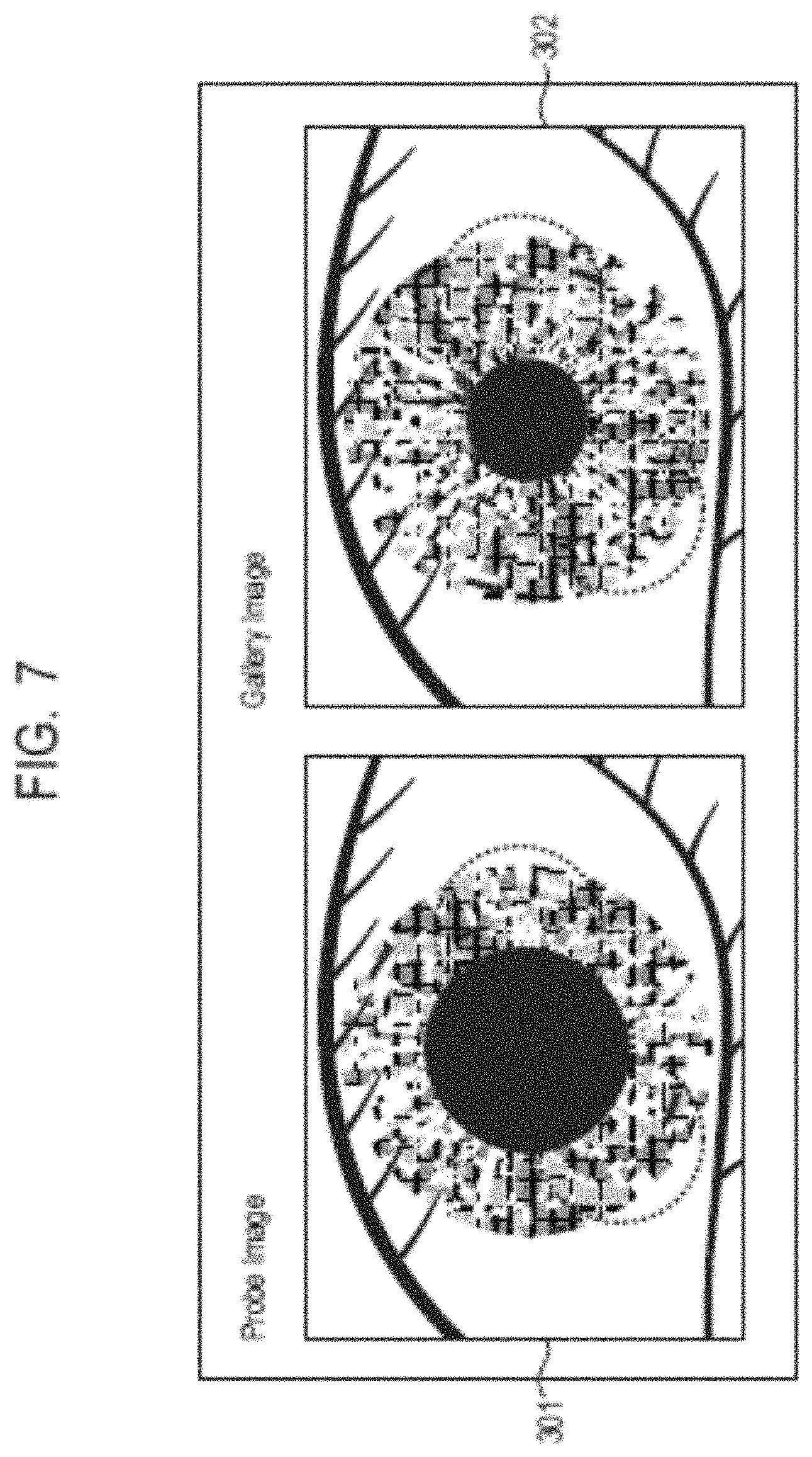 Patent US11776318 Figure 7 – Information processing system, information processing method, and storage medium