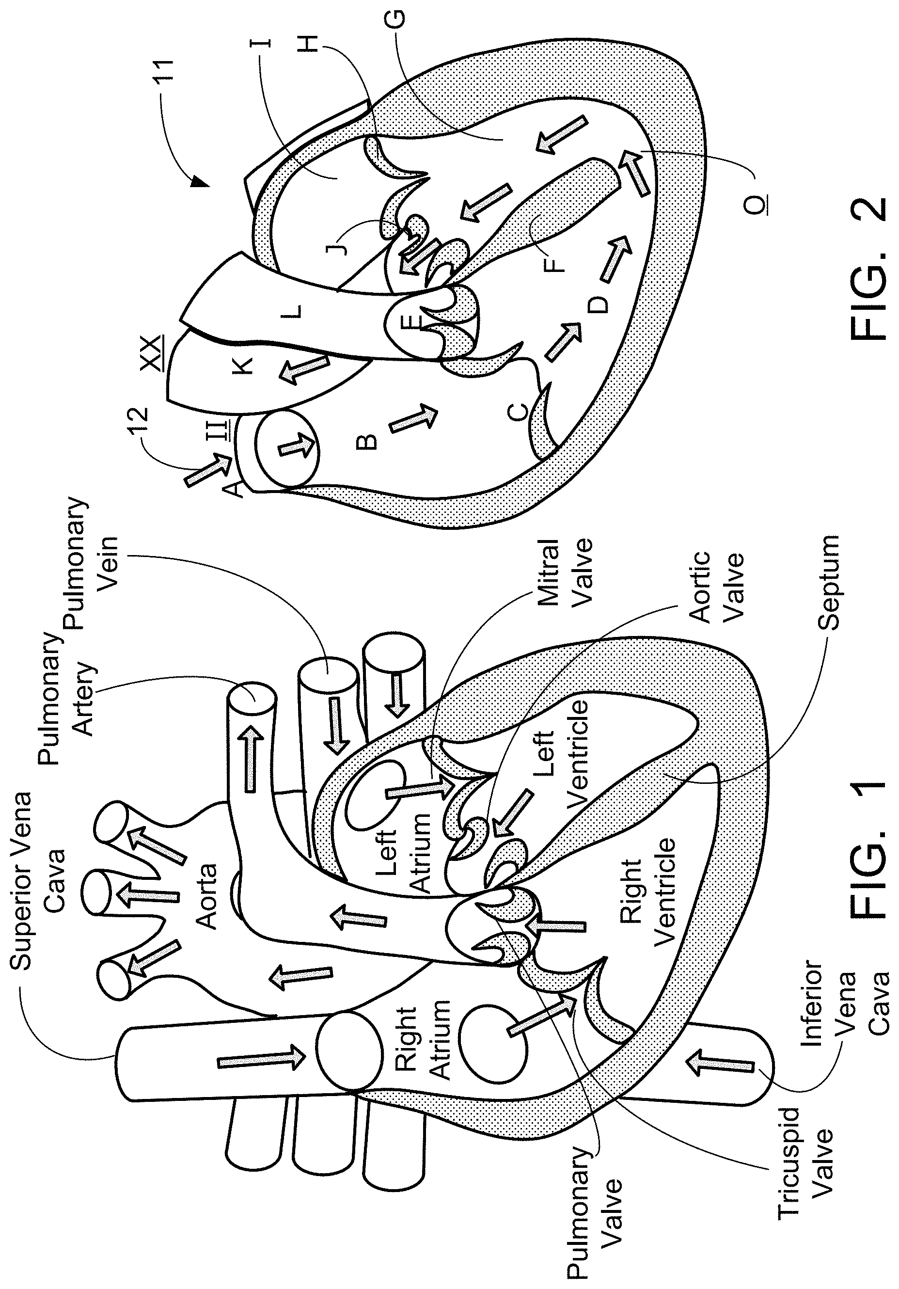 Patent US11776427 — Inflatable exhibit of a human heart and method — Figure 1