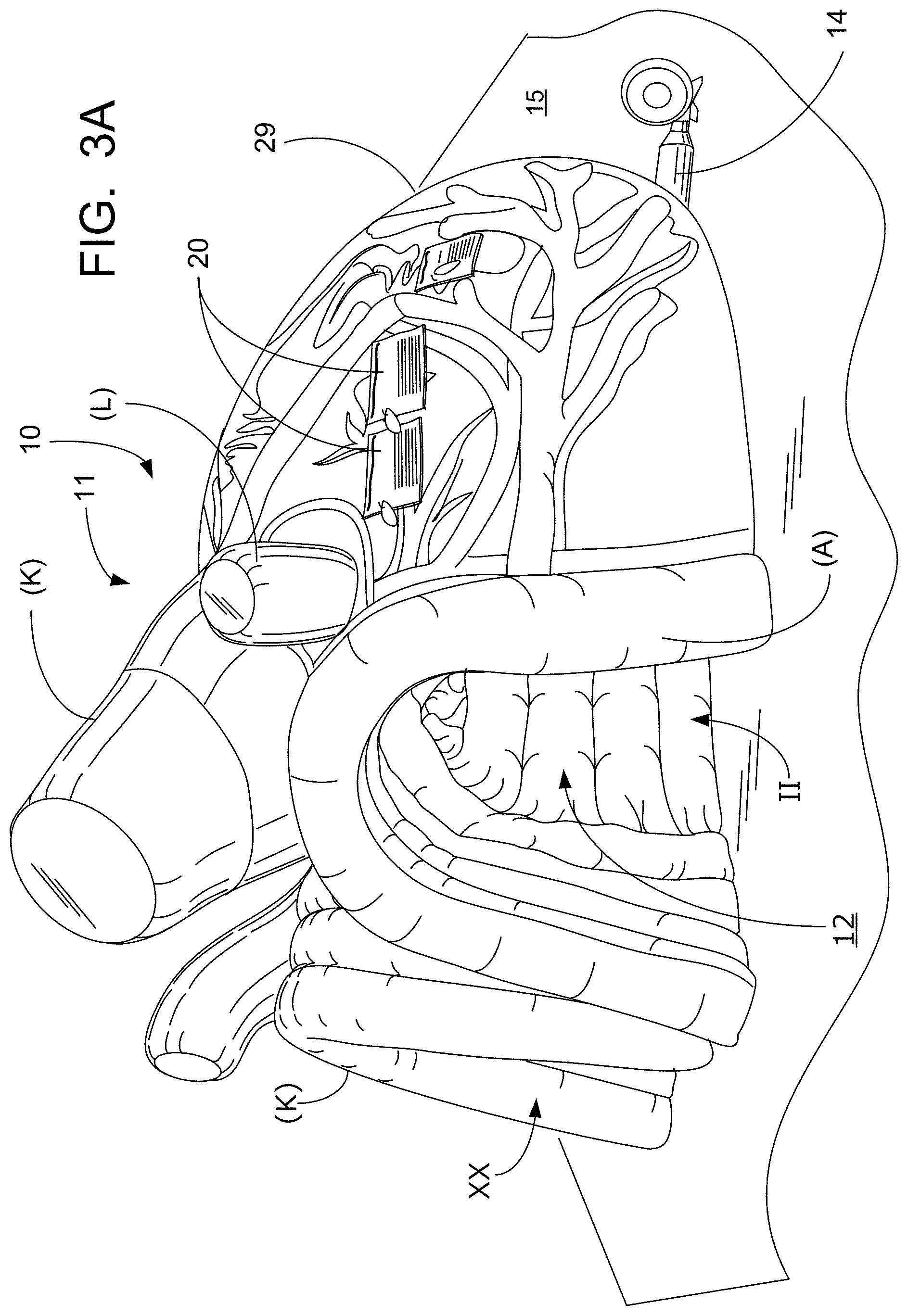 Patent US11776427 Figure 2 – Inflatable exhibit of a human heart and method