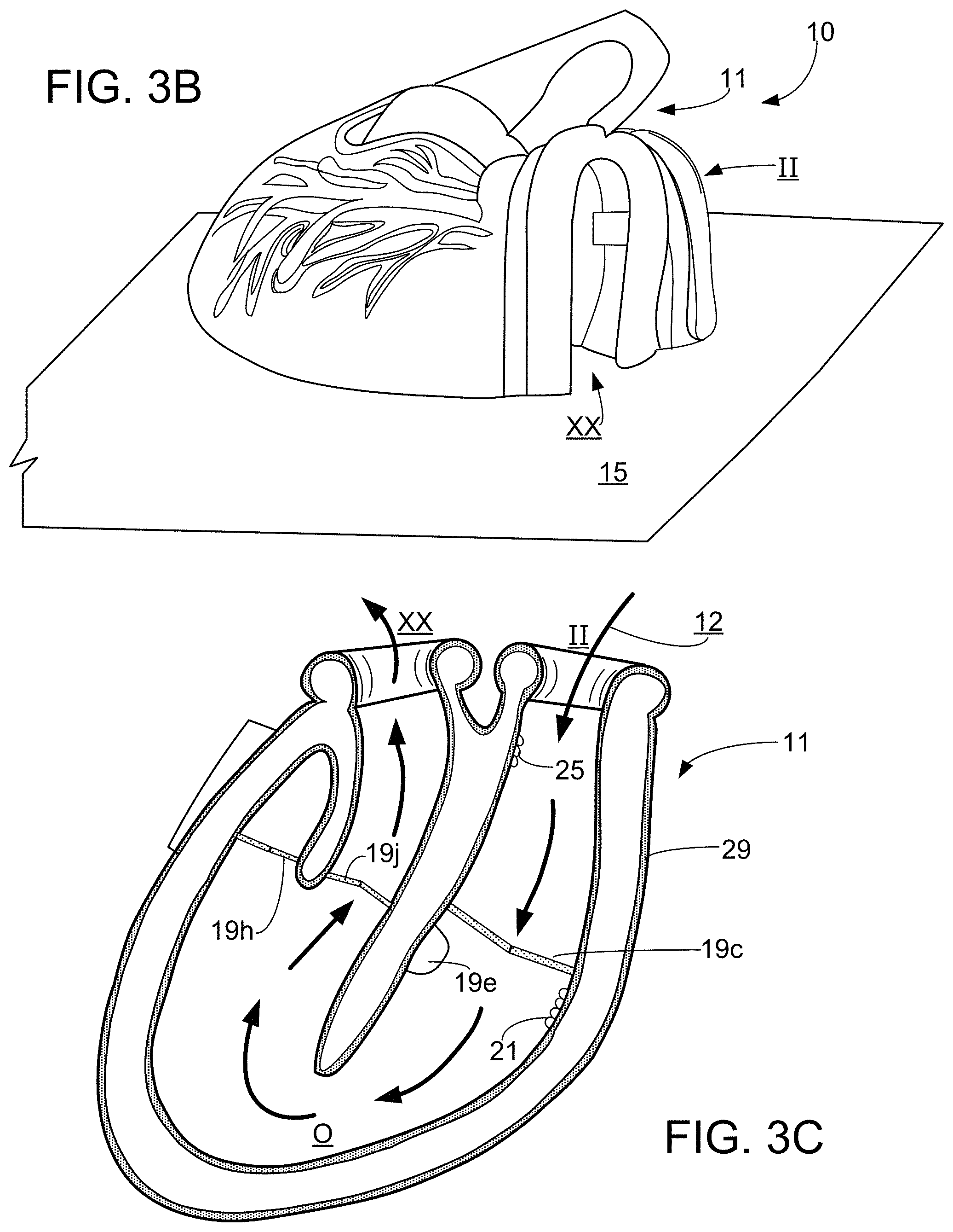 Patent US11776427 Figure 3 – Inflatable exhibit of a human heart and method