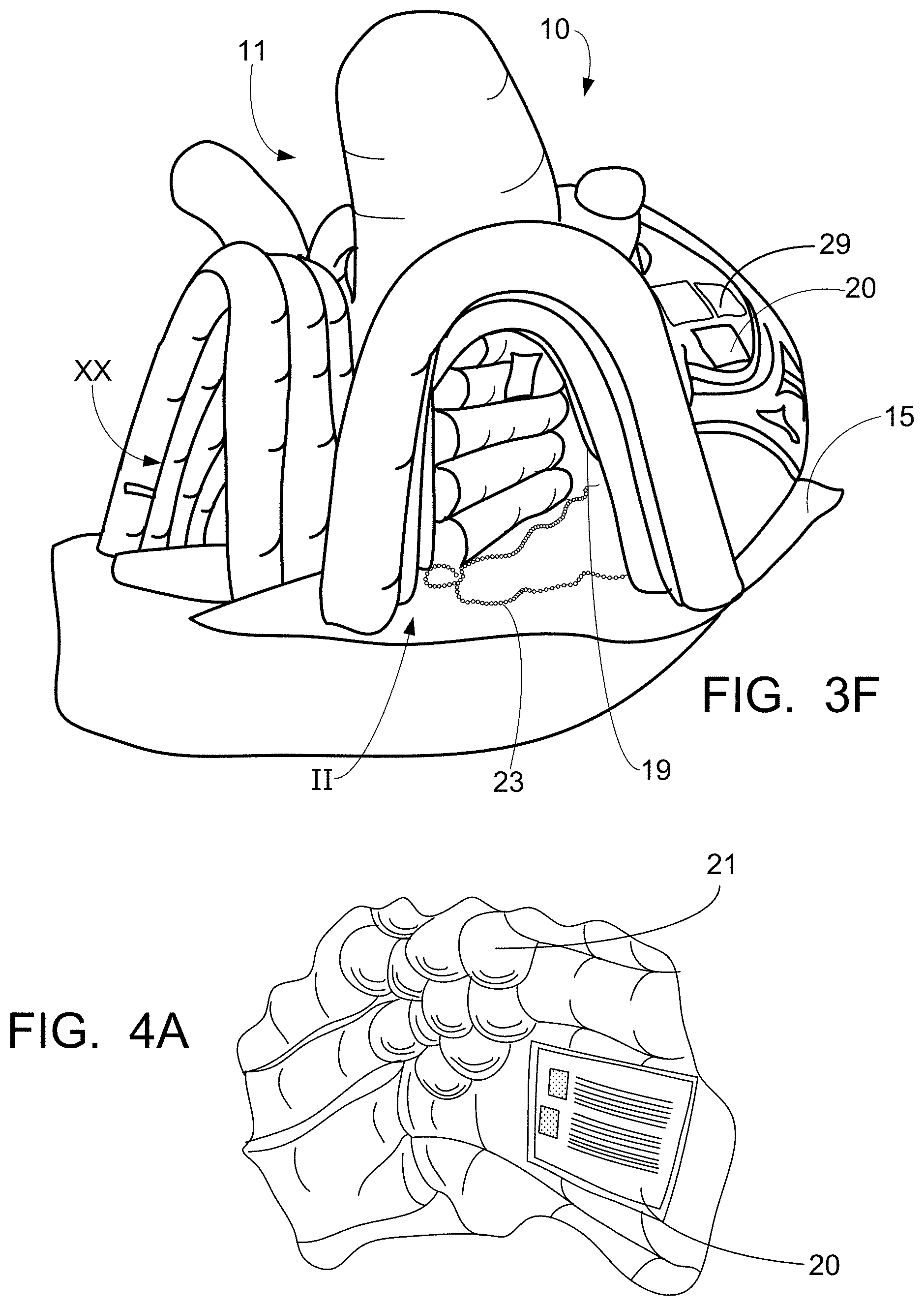 Patent US11776427 Figure 5 – Inflatable exhibit of a human heart and method