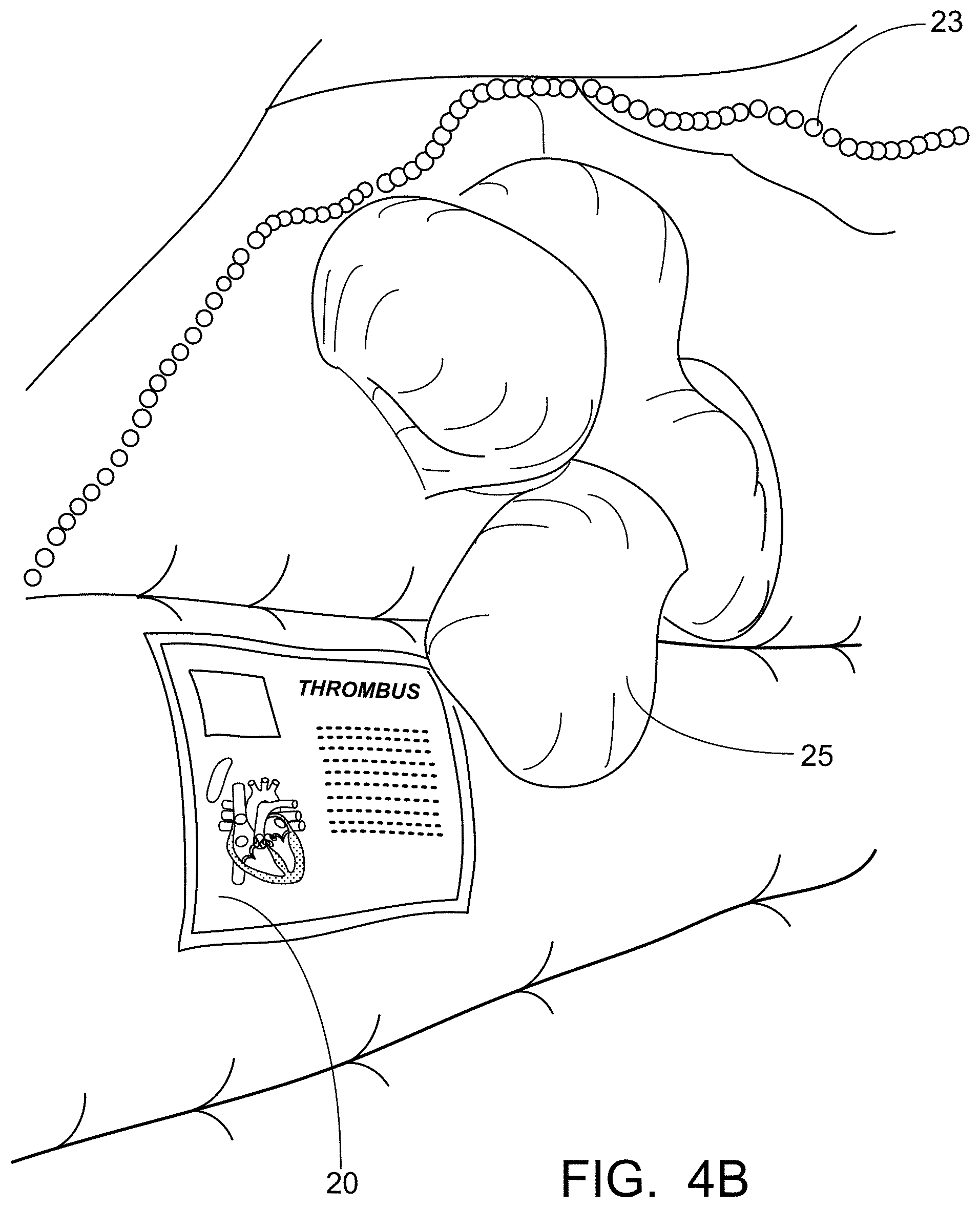 Patent US11776427 Figure 7 – Inflatable exhibit of a human heart and method