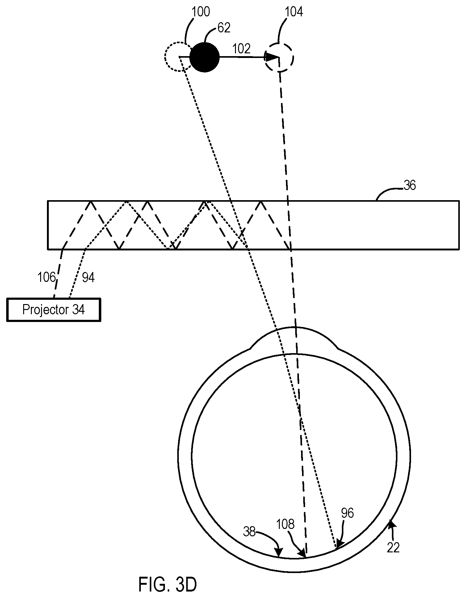 Patent US11776509 Figure 4 – Image correction due to deformation of components of a viewing device