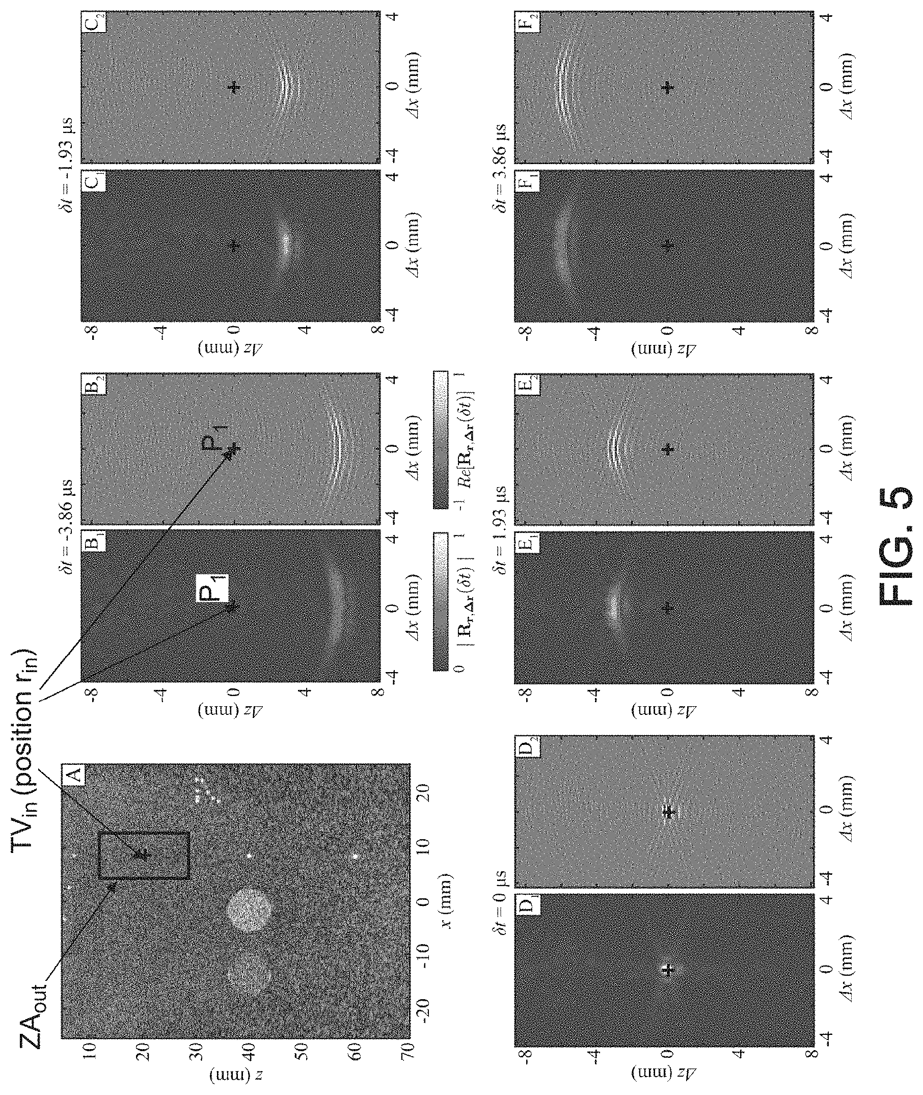 Patent US11776526 Figure 4 – Method and system for ultrasonic characterization of a medium