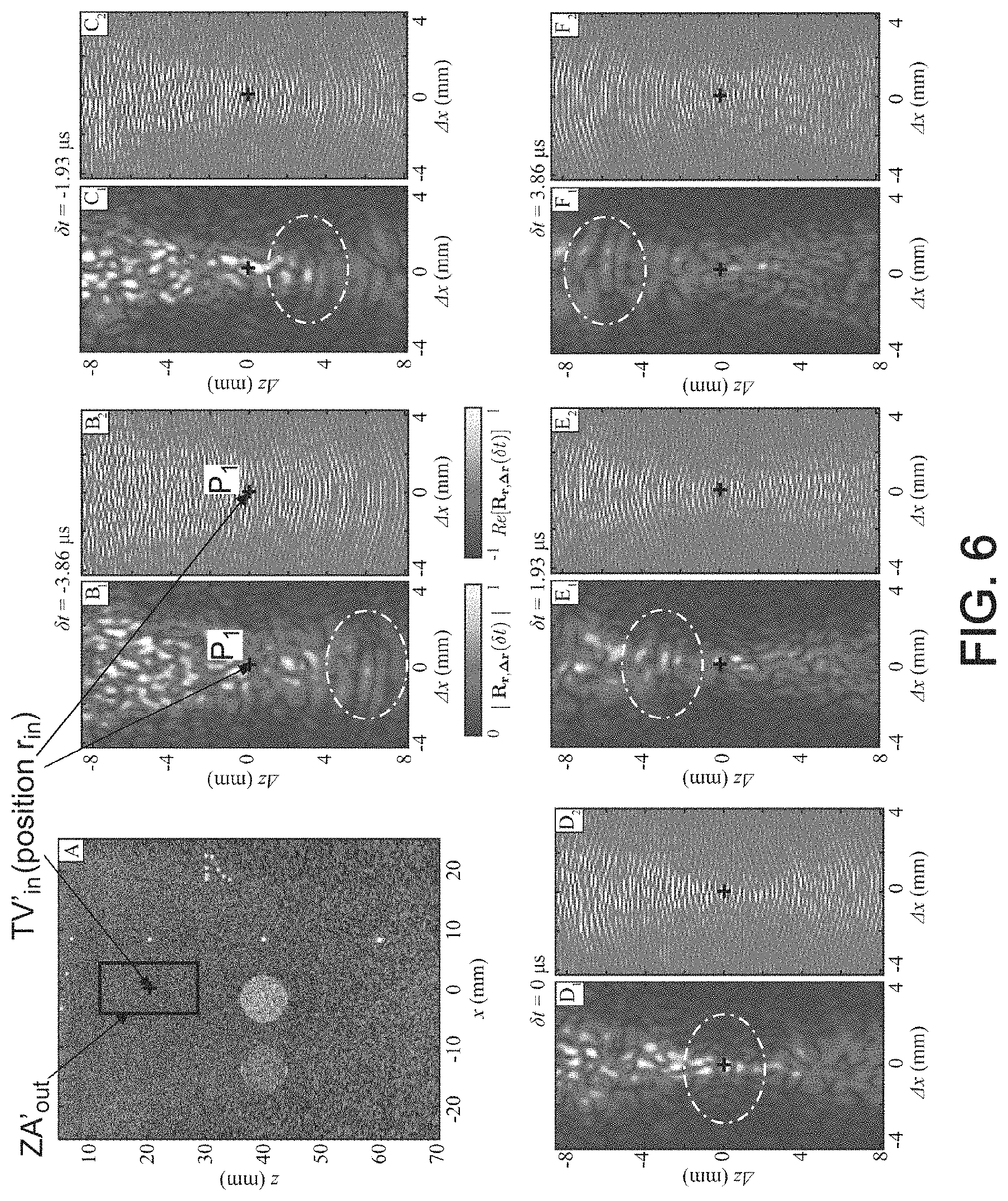Patent US11776526 Figure 5 – Method and system for ultrasonic characterization of a medium