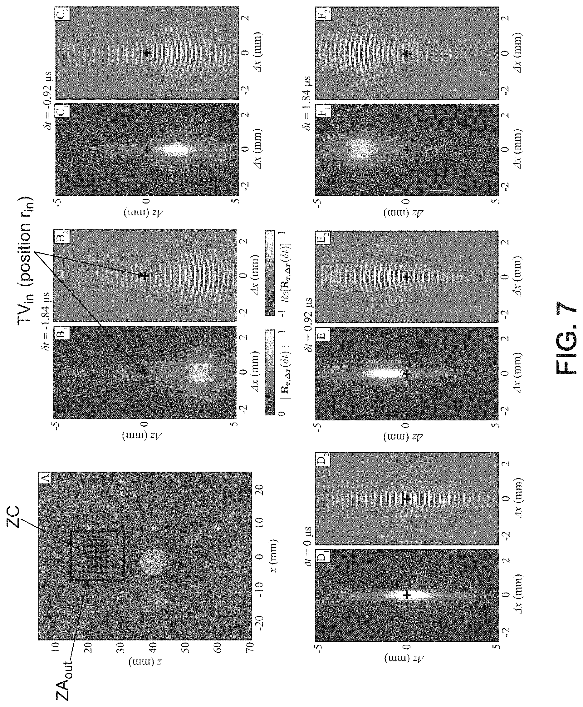 Patent US11776526 Figure 6 – Method and system for ultrasonic characterization of a medium