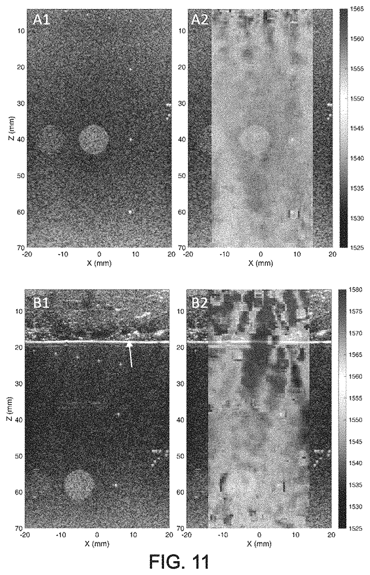 Patent US11776526 Figure 10 – Method and system for ultrasonic characterization of a medium