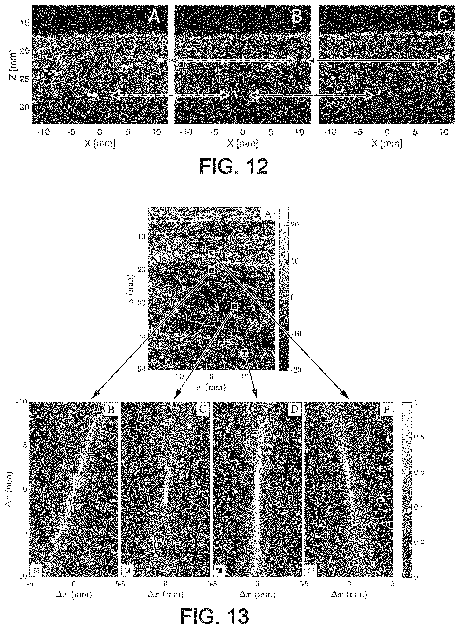 Patent US11776526 Figure 11 – Method and system for ultrasonic characterization of a medium