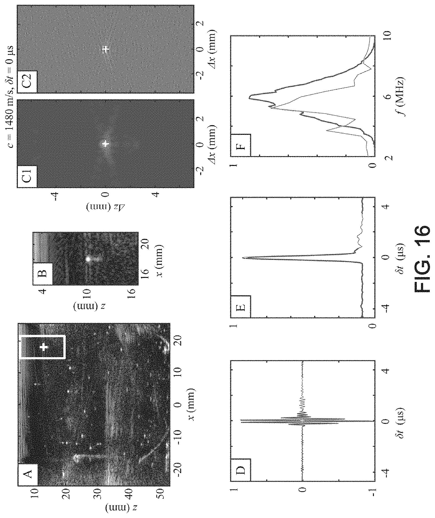 Patent US11776526 Figure 13 – Method and system for ultrasonic characterization of a medium