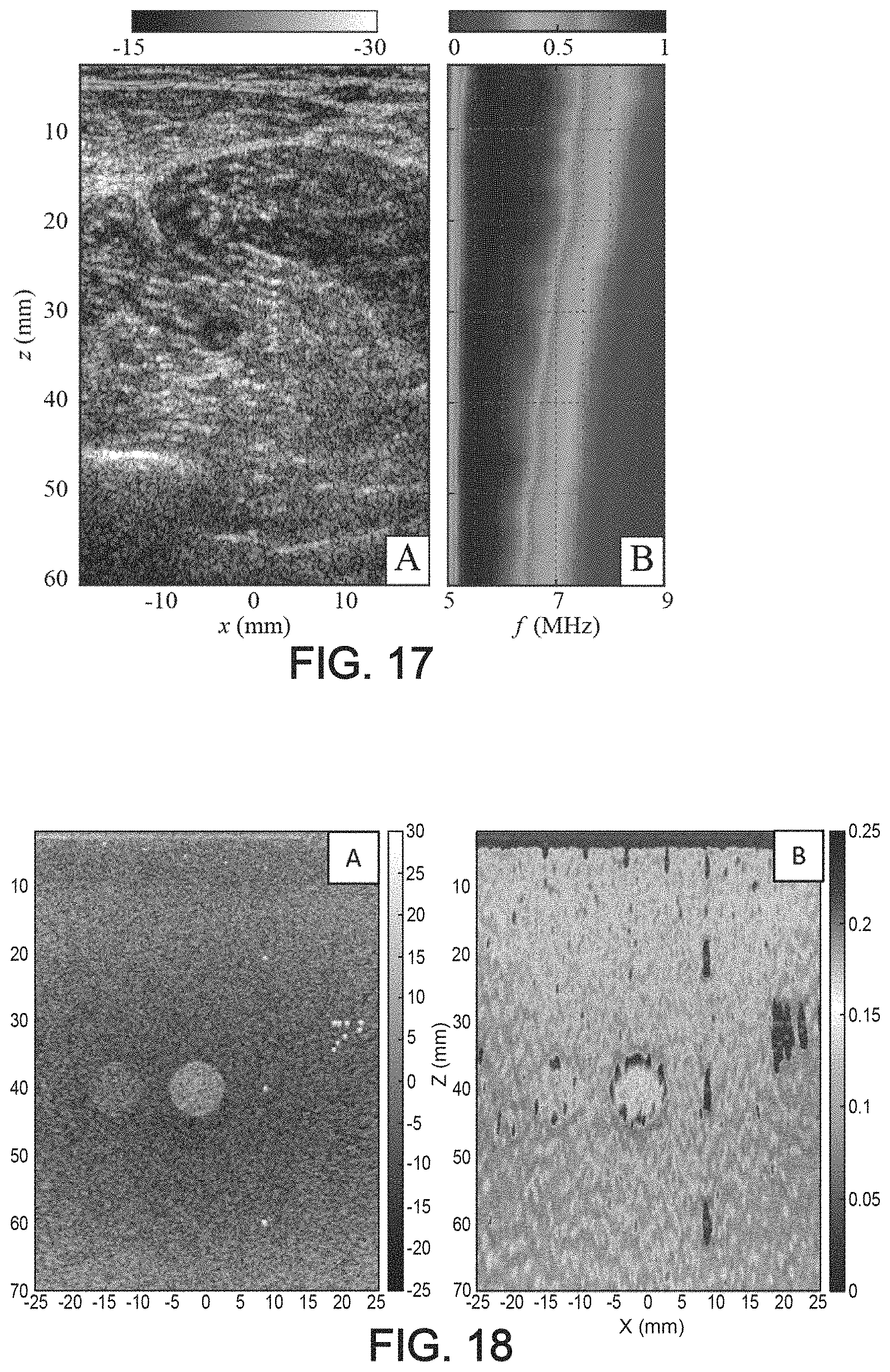 Patent US11776526 Figure 14 – Method and system for ultrasonic characterization of a medium