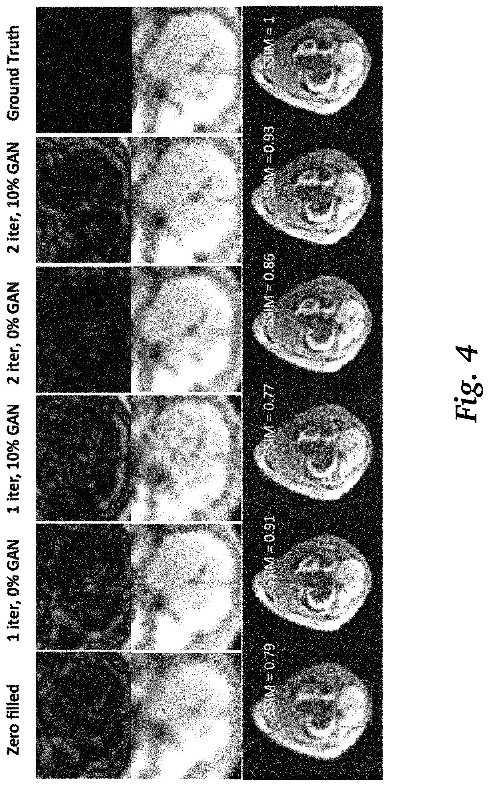 Patent US11776679 Figure 4 – Methods for risk map prediction in AI-based MRI reconstruction