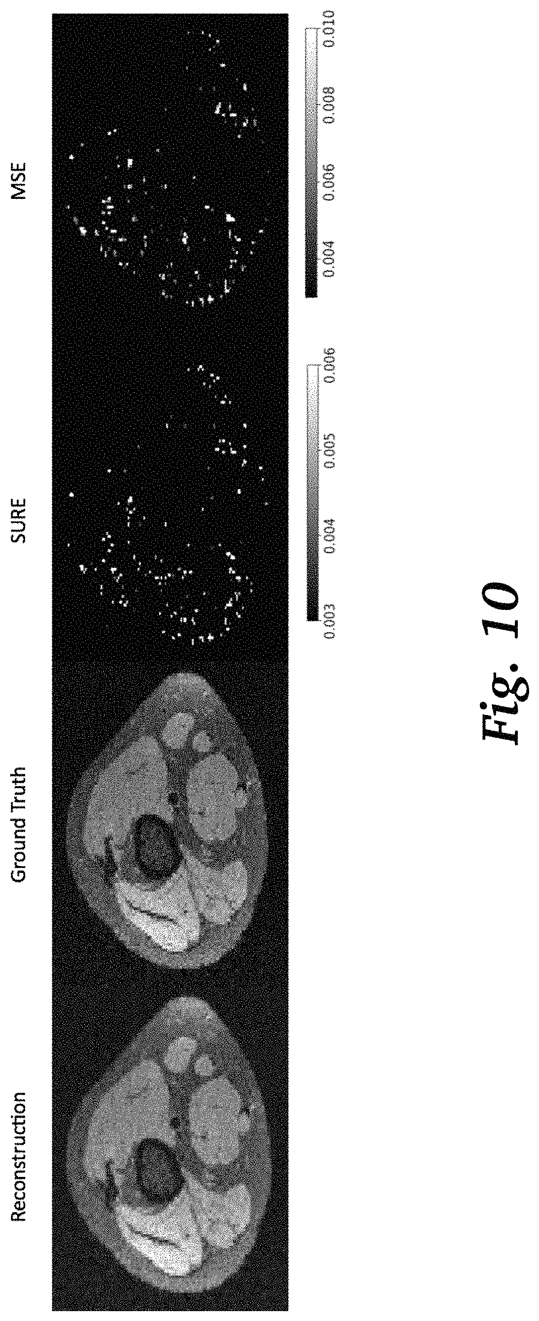 Patent US11776679 Figure 13 – Methods for risk map prediction in AI-based MRI reconstruction
