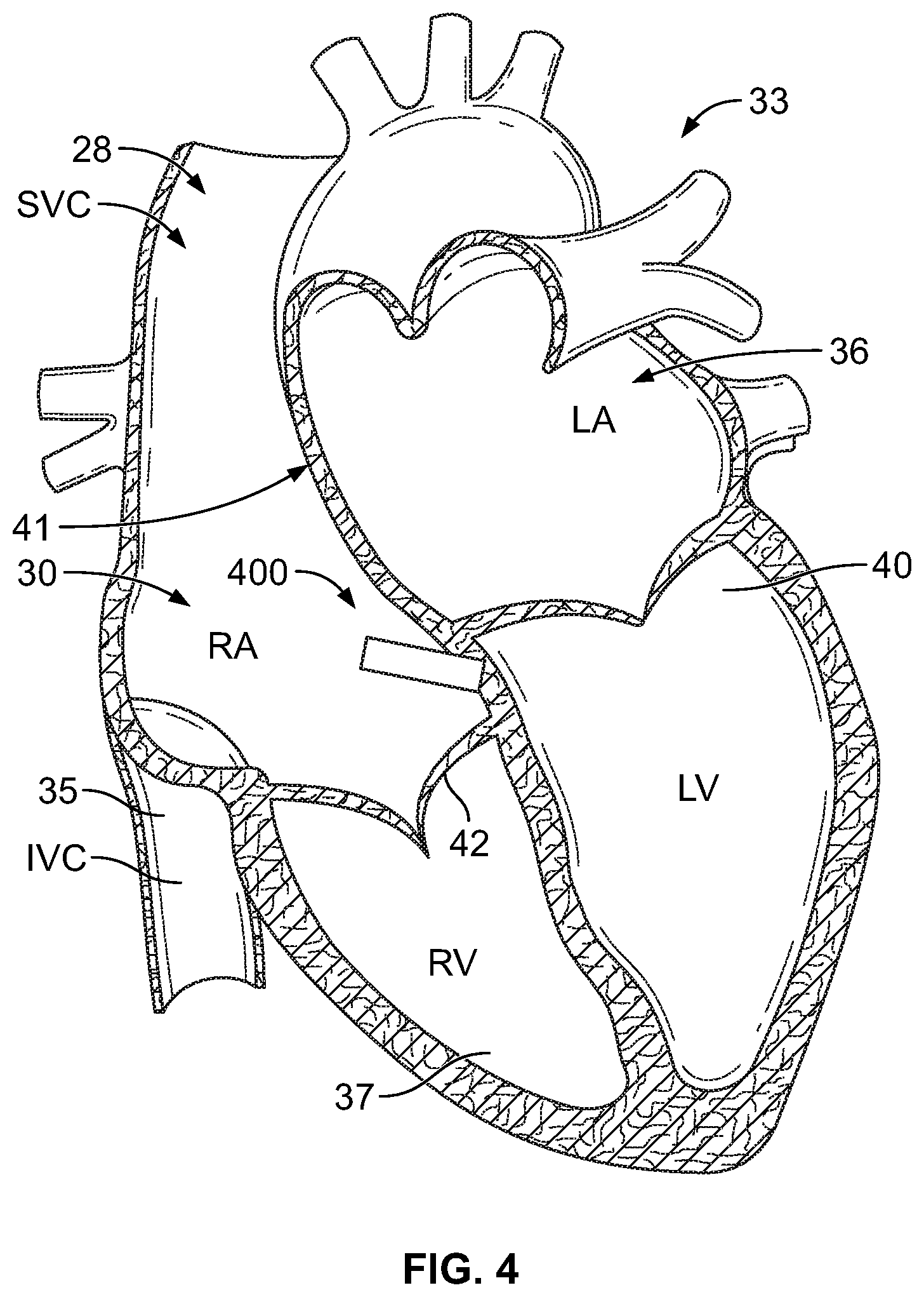 Patent US11776684 Figure 3 – Method and device for managing energy usage by a medical device