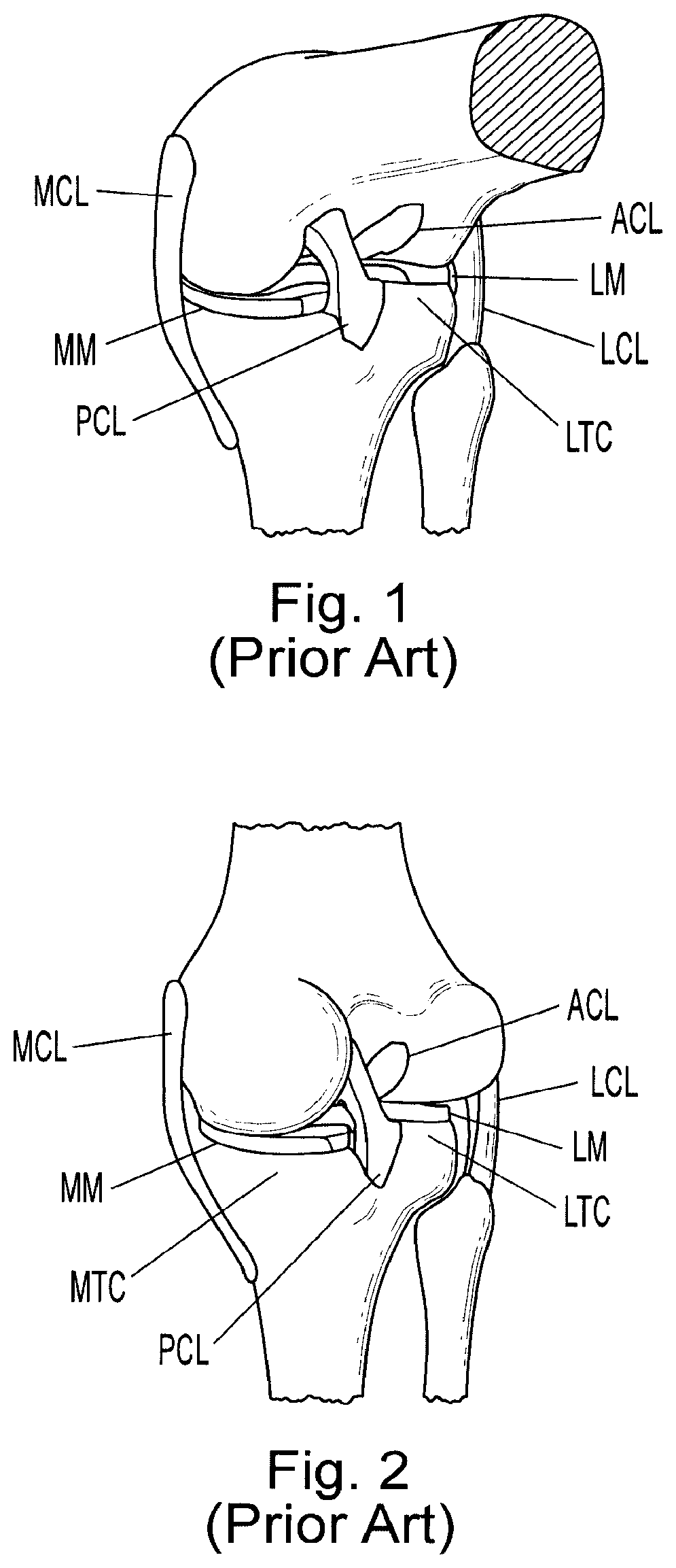 Patent US11776686 Figure 1 – Noninvasive diagnostic system