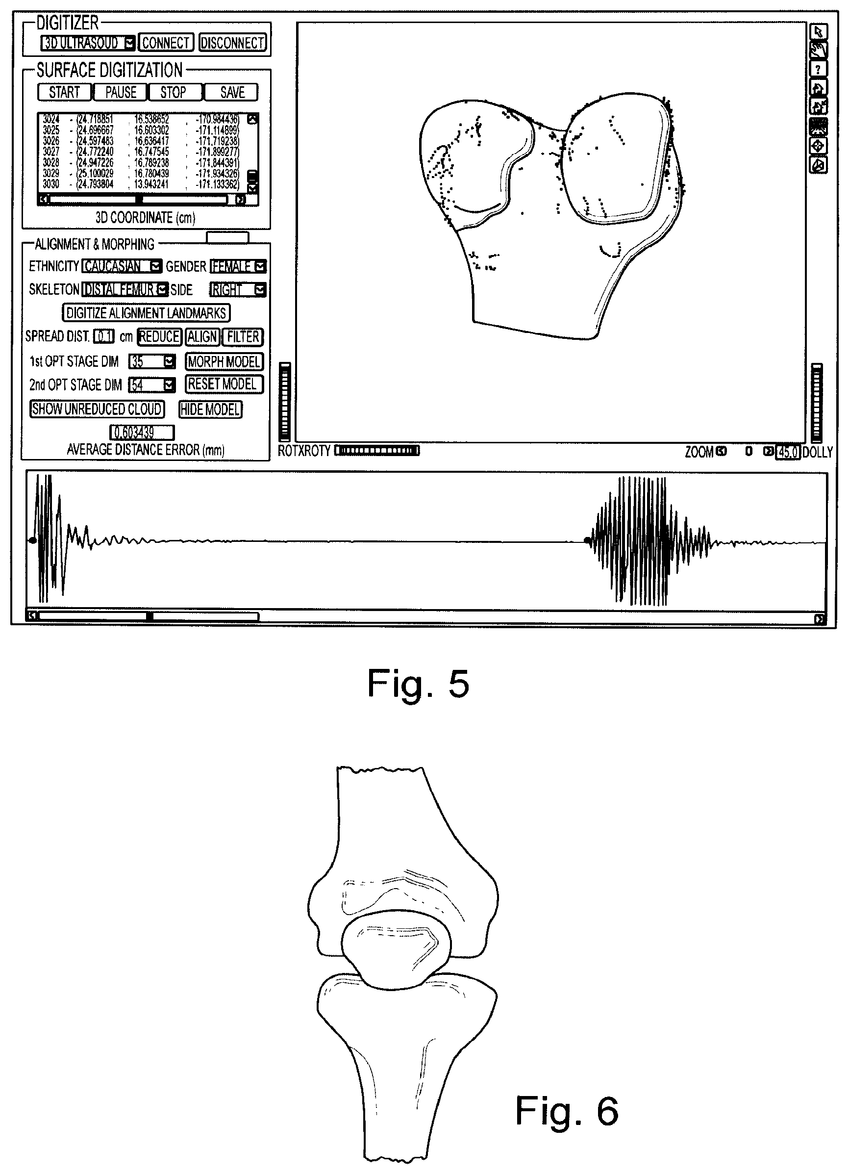 Patent US11776686 Figure 3 – Noninvasive diagnostic system