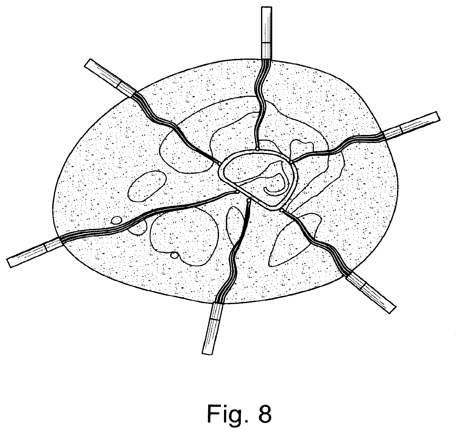 Patent US11776686 Figure 5 – Noninvasive diagnostic system
