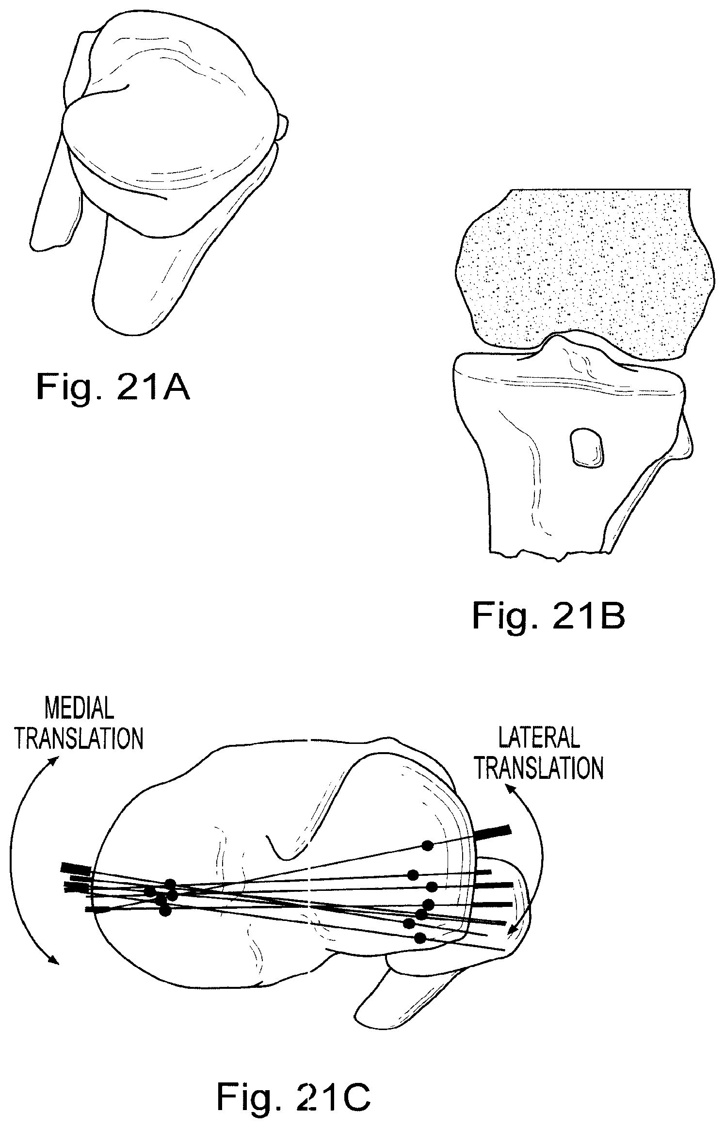 Patent US11776686 Figure 13 – Noninvasive diagnostic system
