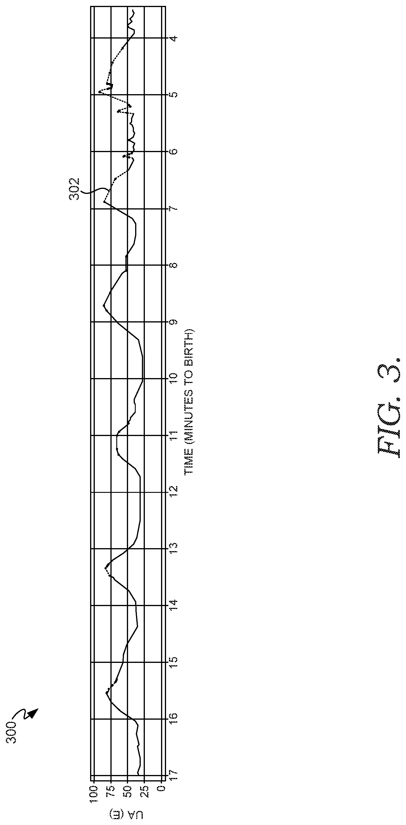 Patent US11776690 Figure 4 – Forecasting uterine activity