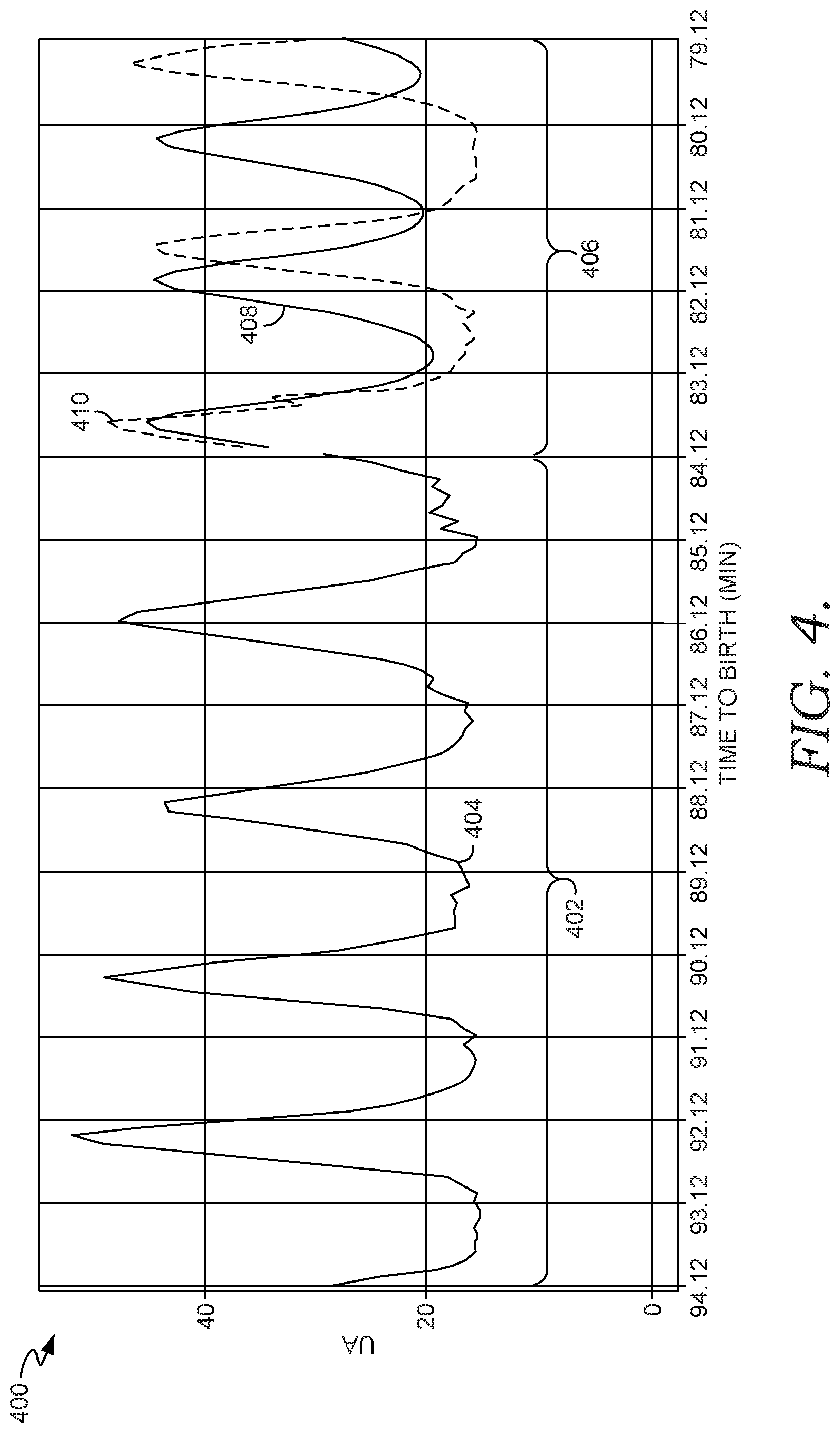 Patent US11776690 Figure 5 – Forecasting uterine activity